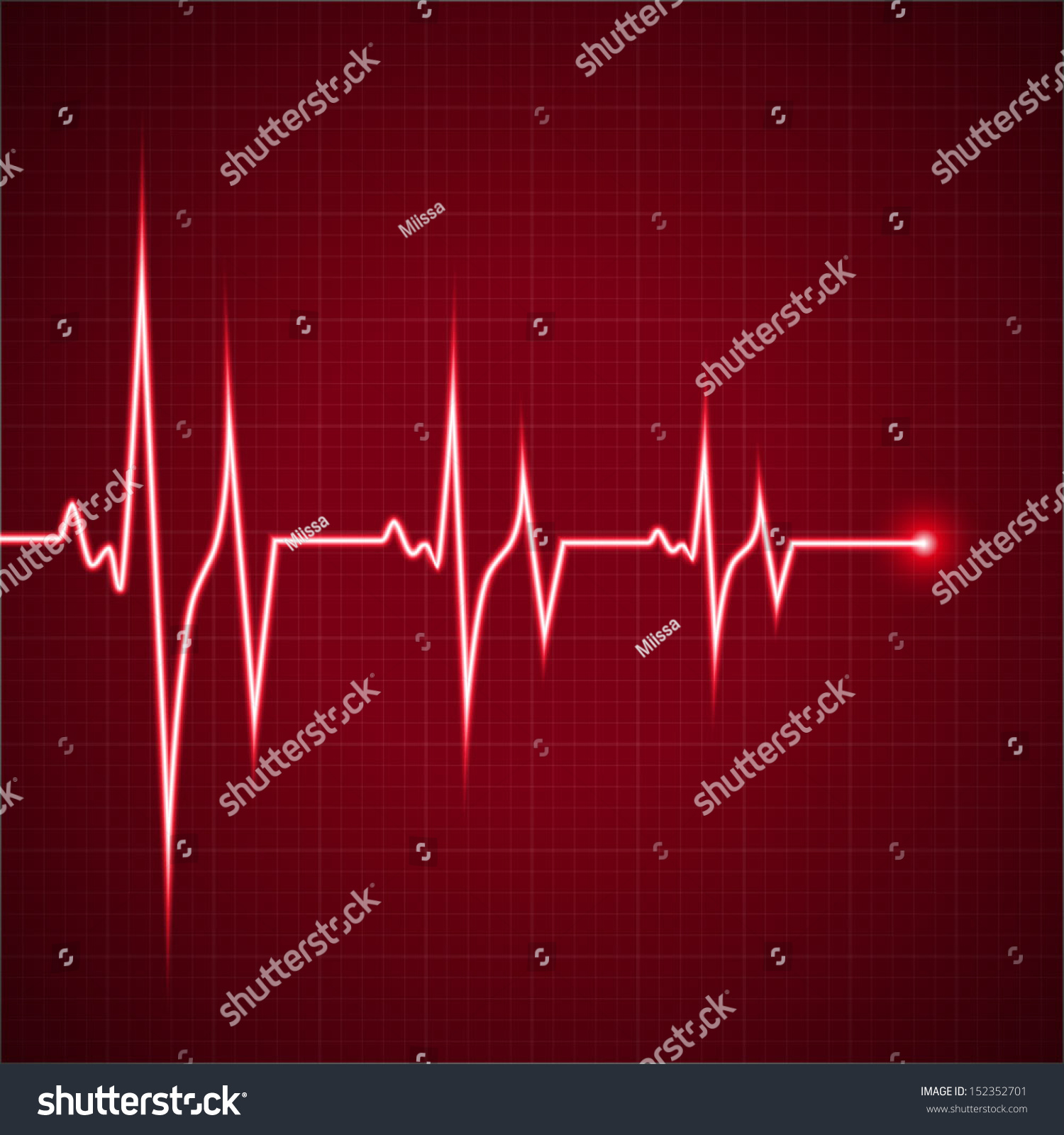 Vector Illustration Heart Rhythm Ekg Stock Vector Royalty Free