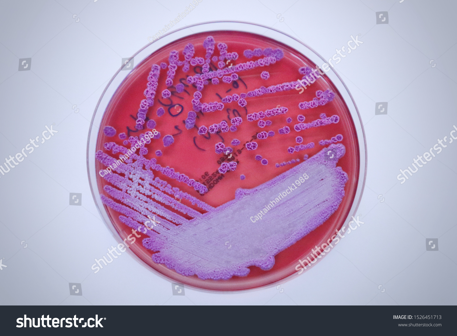 46 Burkholderia Pseudomallei Images, Stock Photos & Vectors | Shutterstock