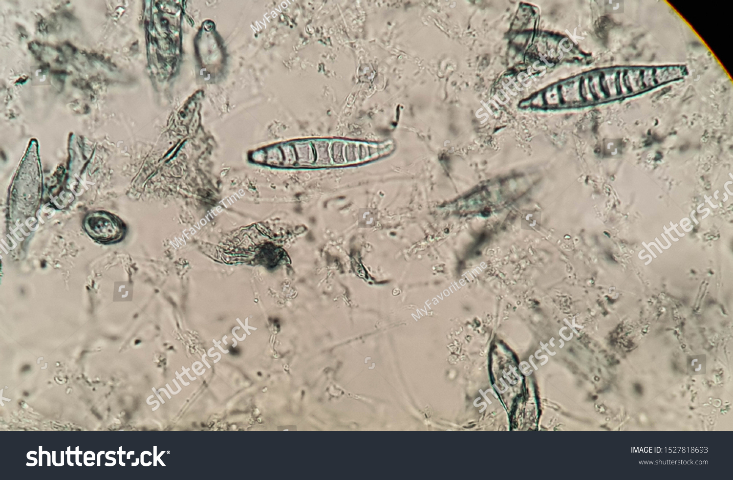 Микроспорум Канис под микроскопом