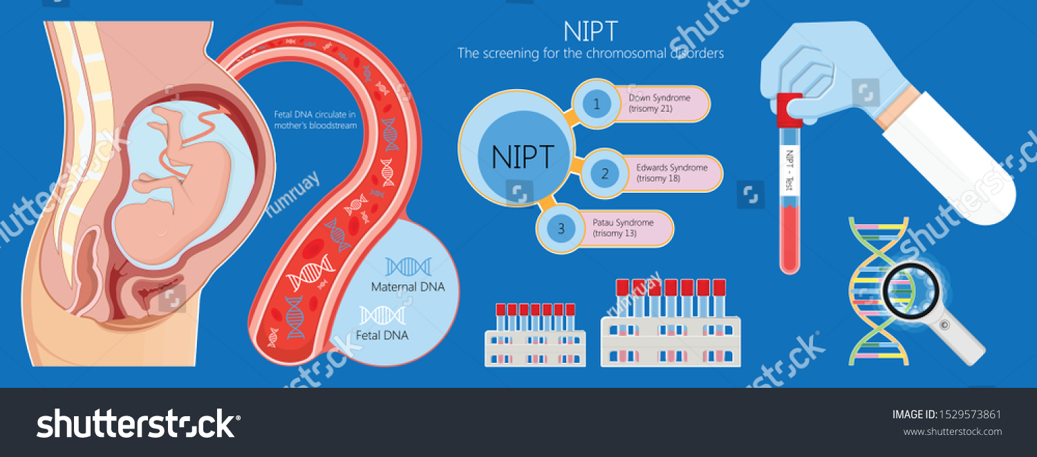 Неинвазивное пренатальное тестирование. Неинвазивный пренатальный скрининг. Неинвазивный пренатальный тест (НИПТ). НИПТ скрининг.