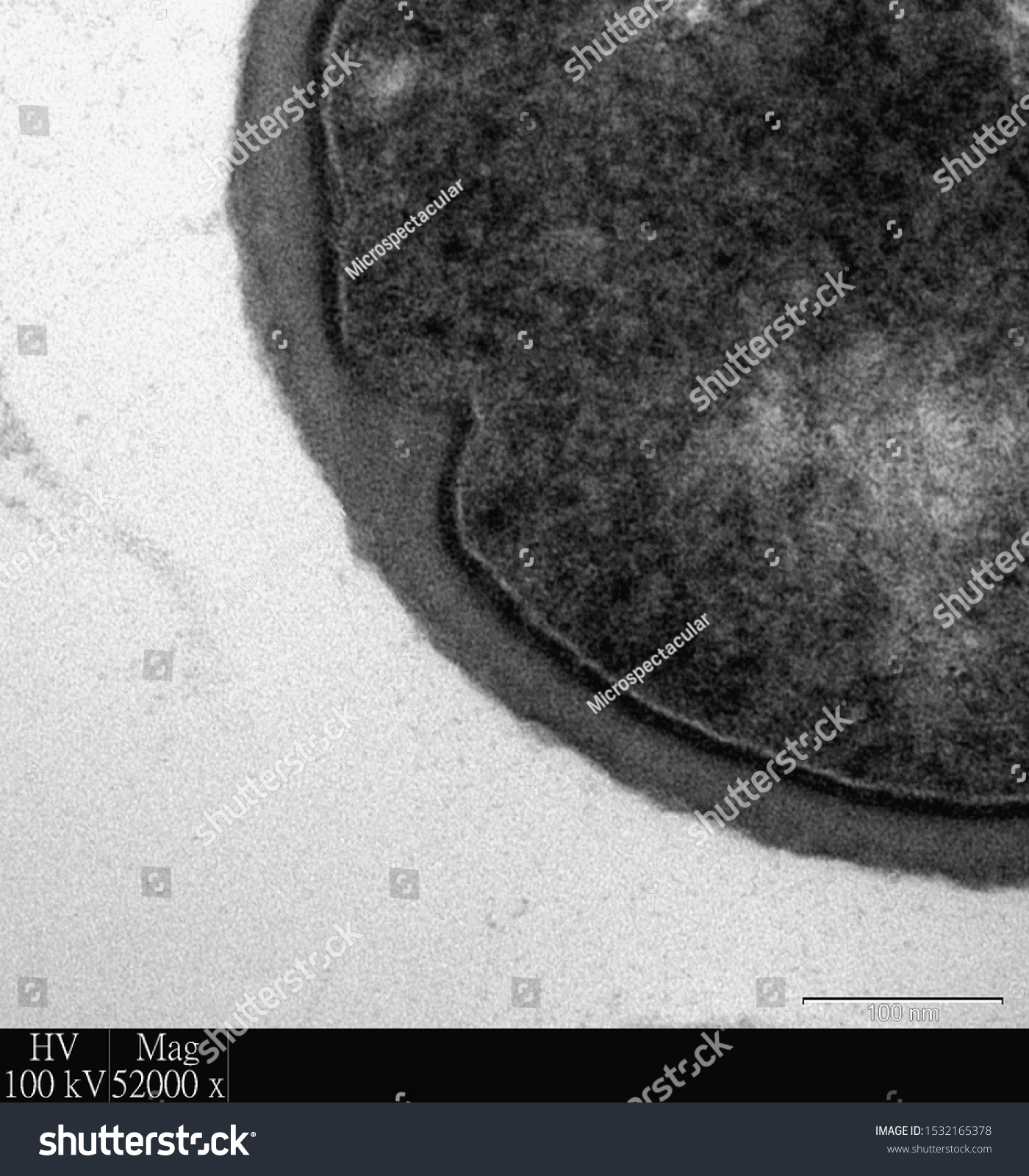 Ultrastructure Gram Positive Bacteria Showing Cell Stock Photo ...