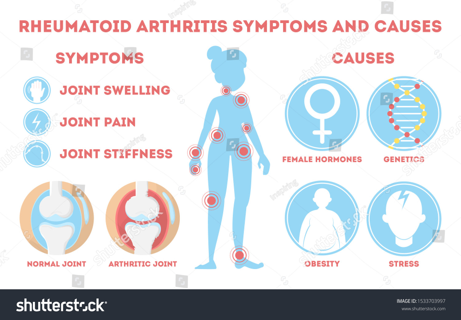 Rheumatism Infographic Bone Disease On Foot Stock Illustration ...