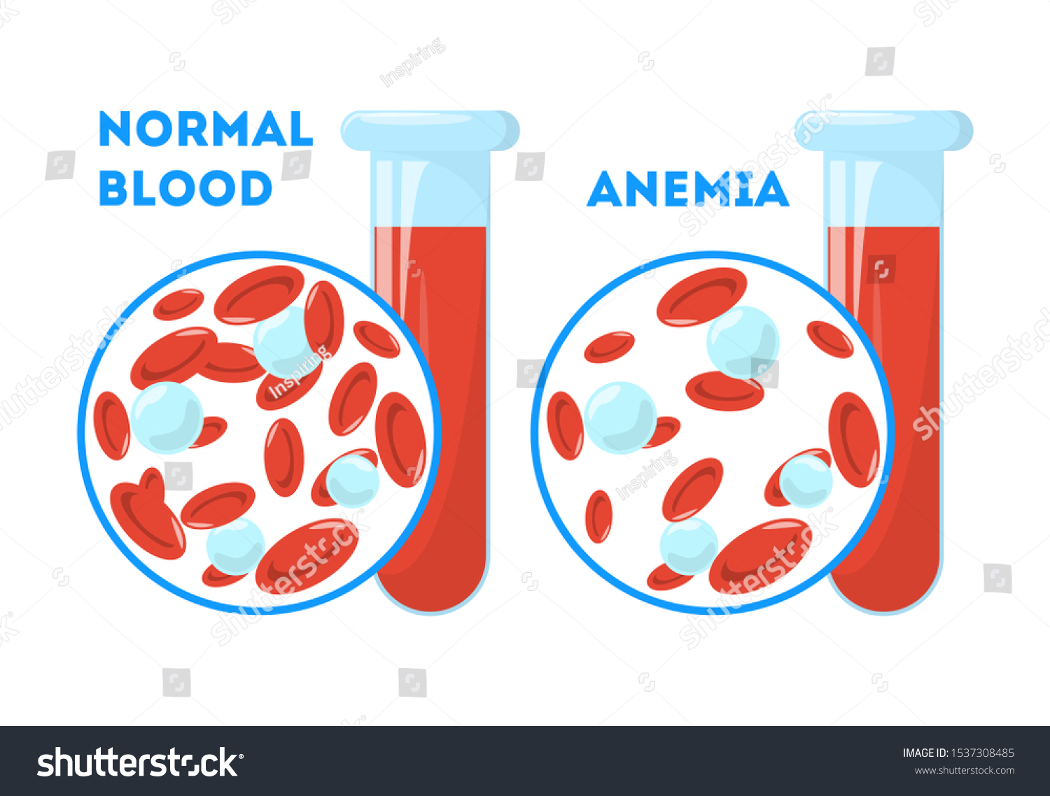 стол при анемии железодефицитной анемии у