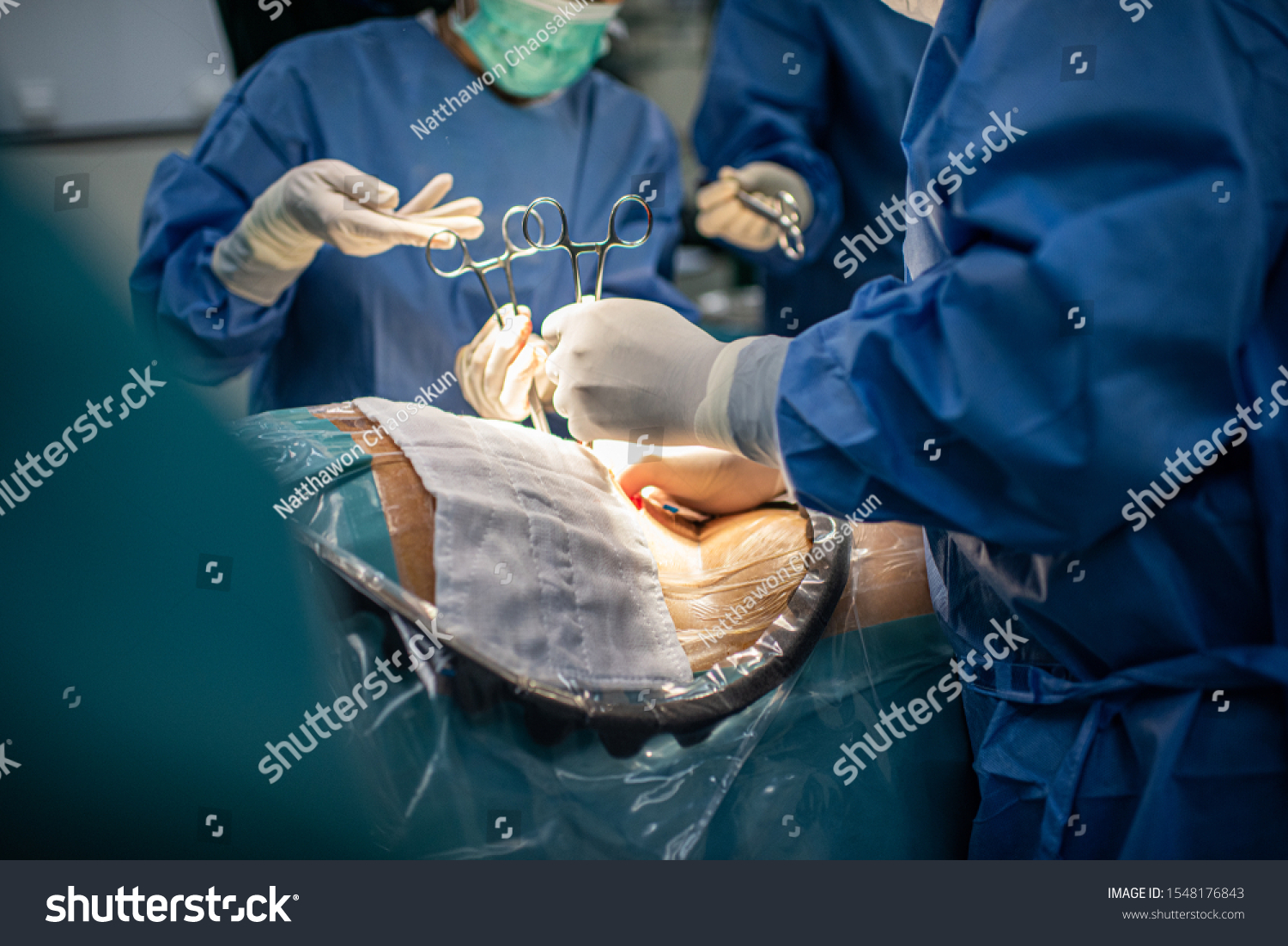 Classic Cesarean Section Operating Theater Labor Stock Photo 1548176843 ...