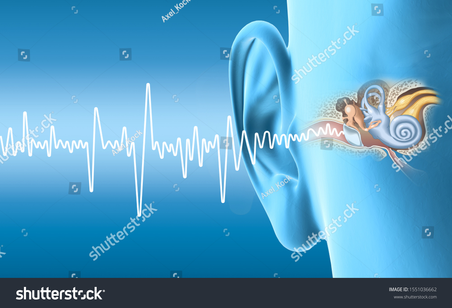 Human Ear Anatomy Soundwaves On Blue Stock Illustration 1551036662 ...