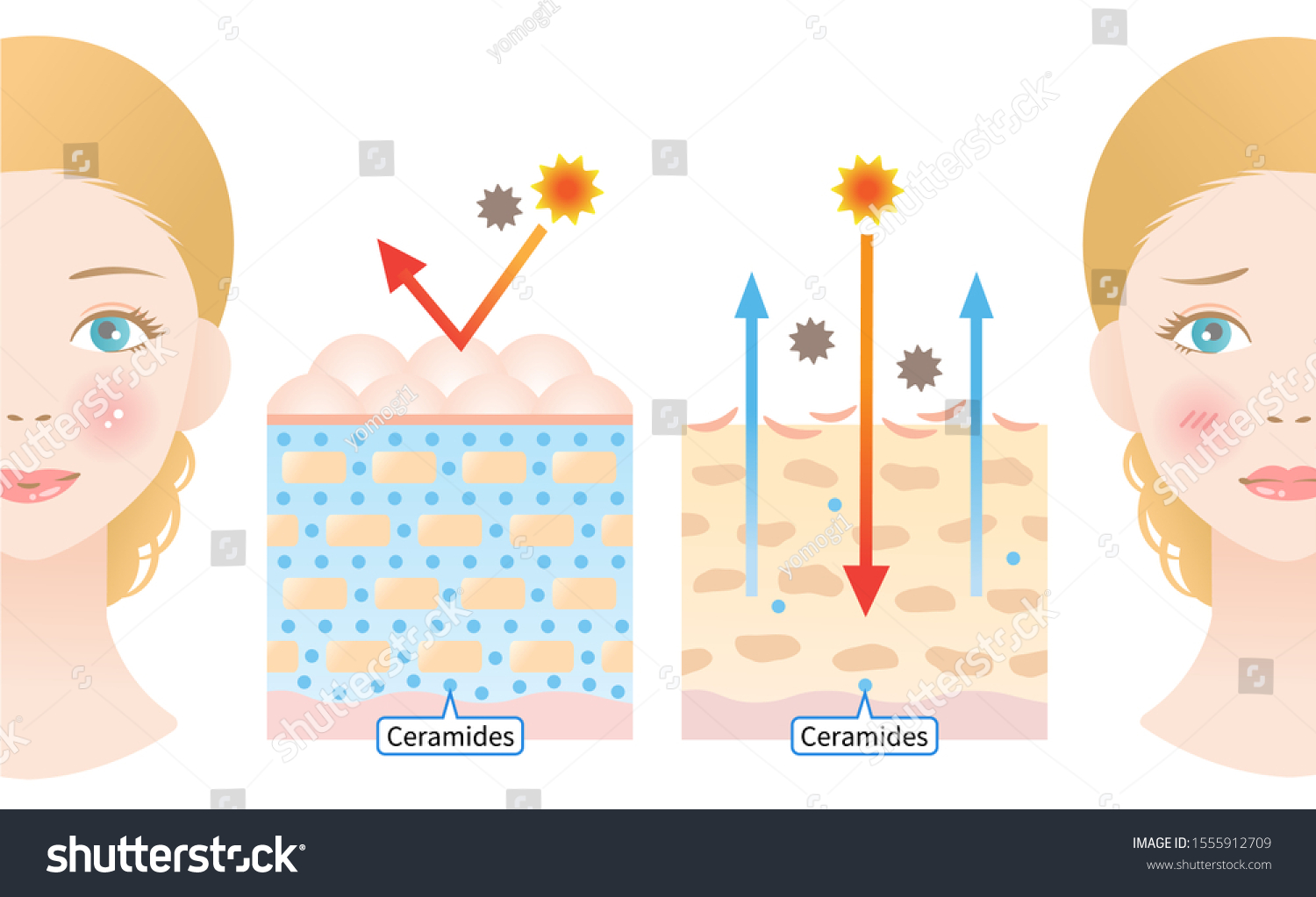 Young Skin Contains Ceramides That Produce Stock Vector (royalty Free 