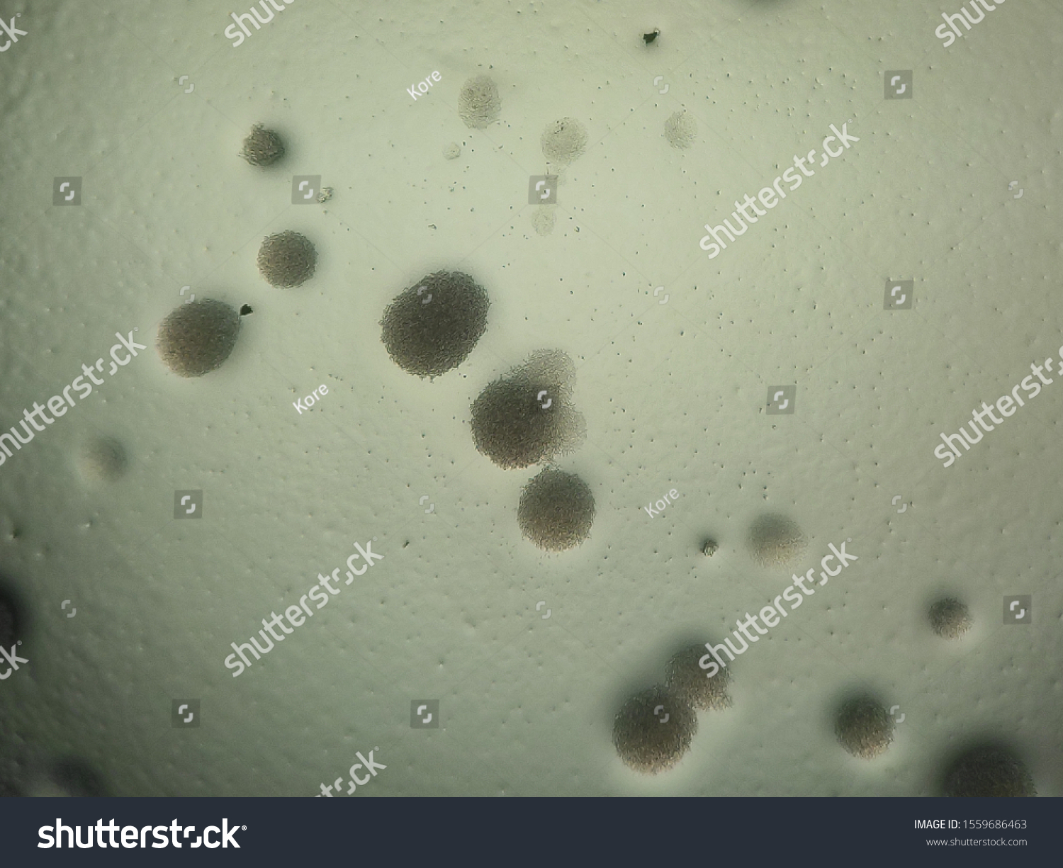 Candida Albicans Colonies Under Microscope Stock Photo 1559686463 ...