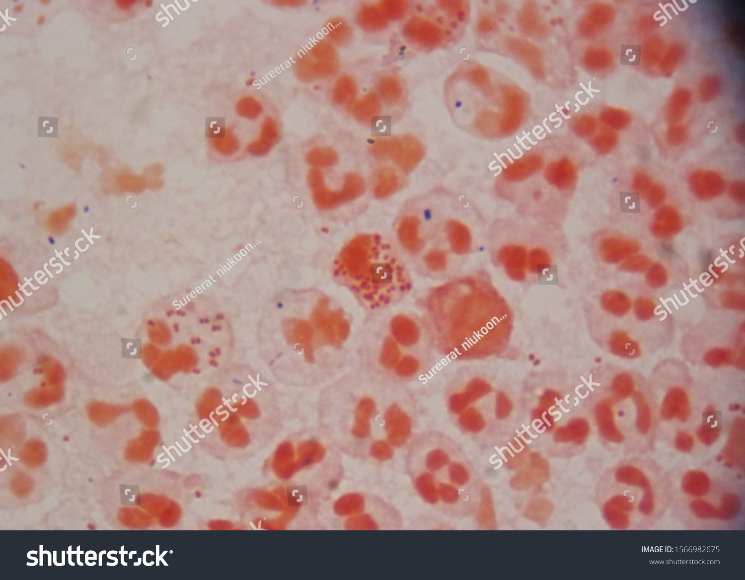 Gram Stain Neisseria Gonorrhoeae Sexually Transmitted Stock Photo Shutterstock