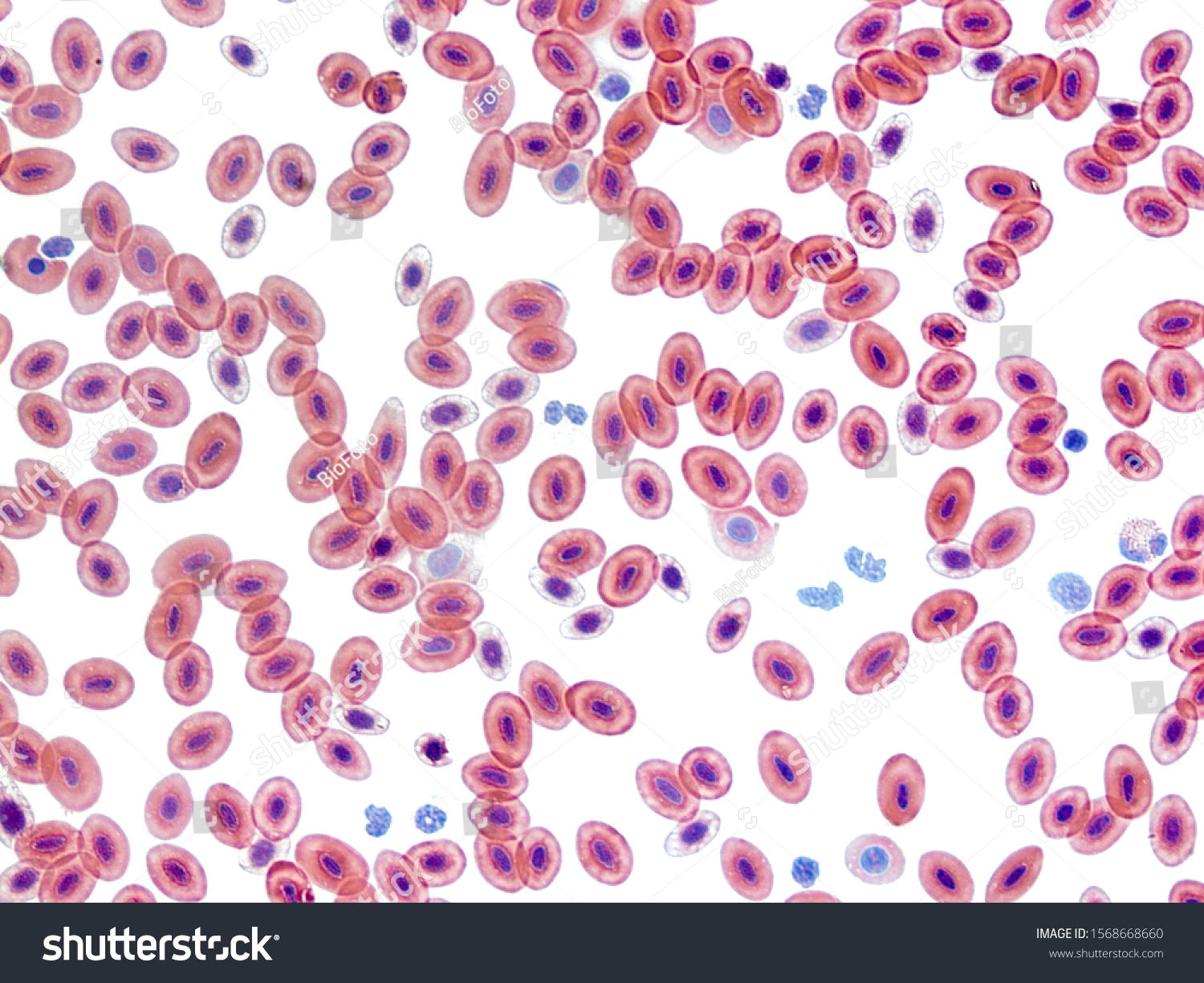 151-nucleated-red-blood-cells-bilder-stockfotos-und-vektorgrafiken