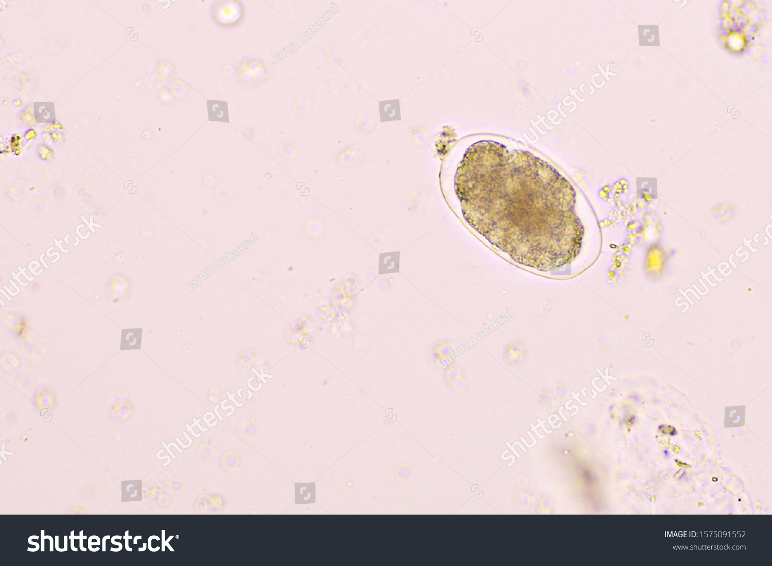 Eggs Hookworm Human Stool Analyze By Stock Photo 1575091552 | Shutterstock