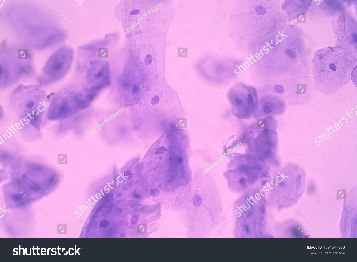 Human Cheek Epithelial Cells Tissue That Stock Photo 1591544908 ...