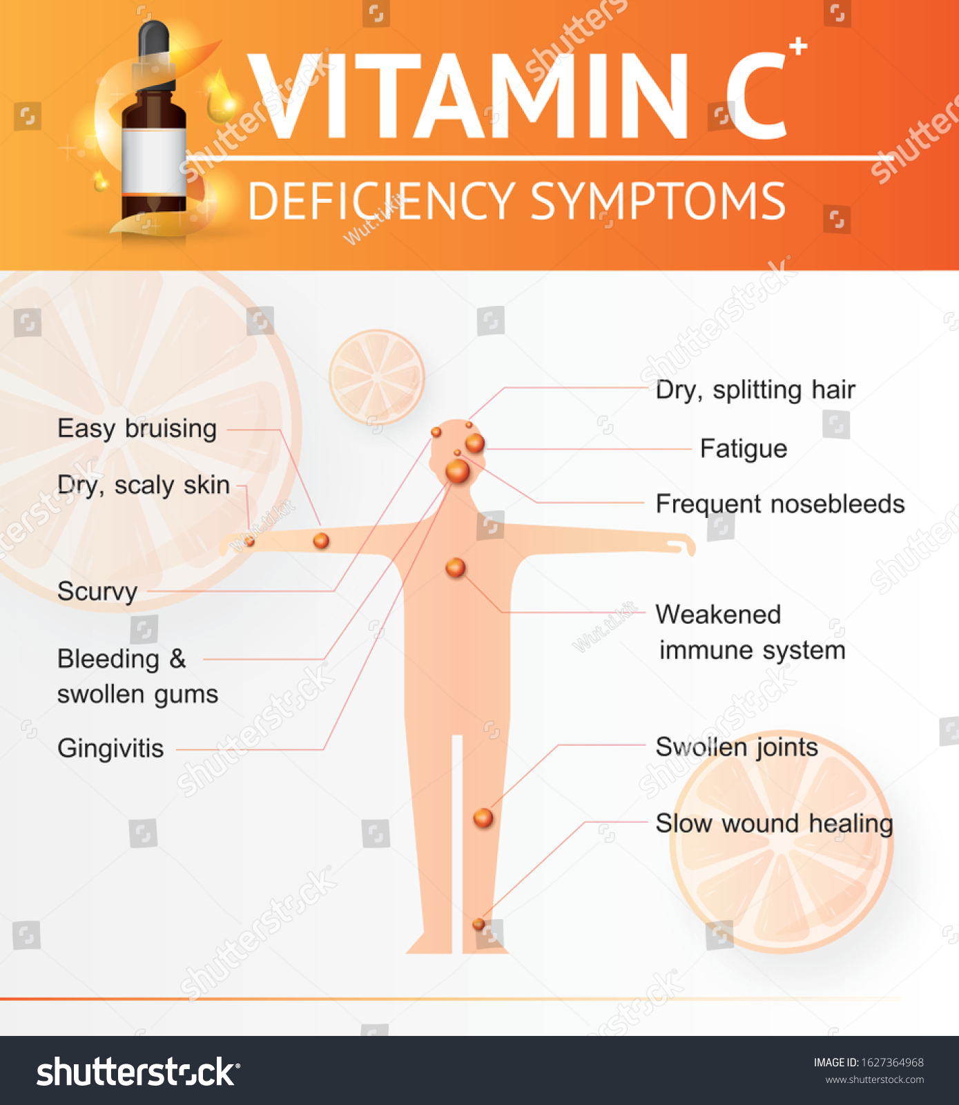vitamin c deficiency symptoms infographic human 库存矢量图免版税1627364968