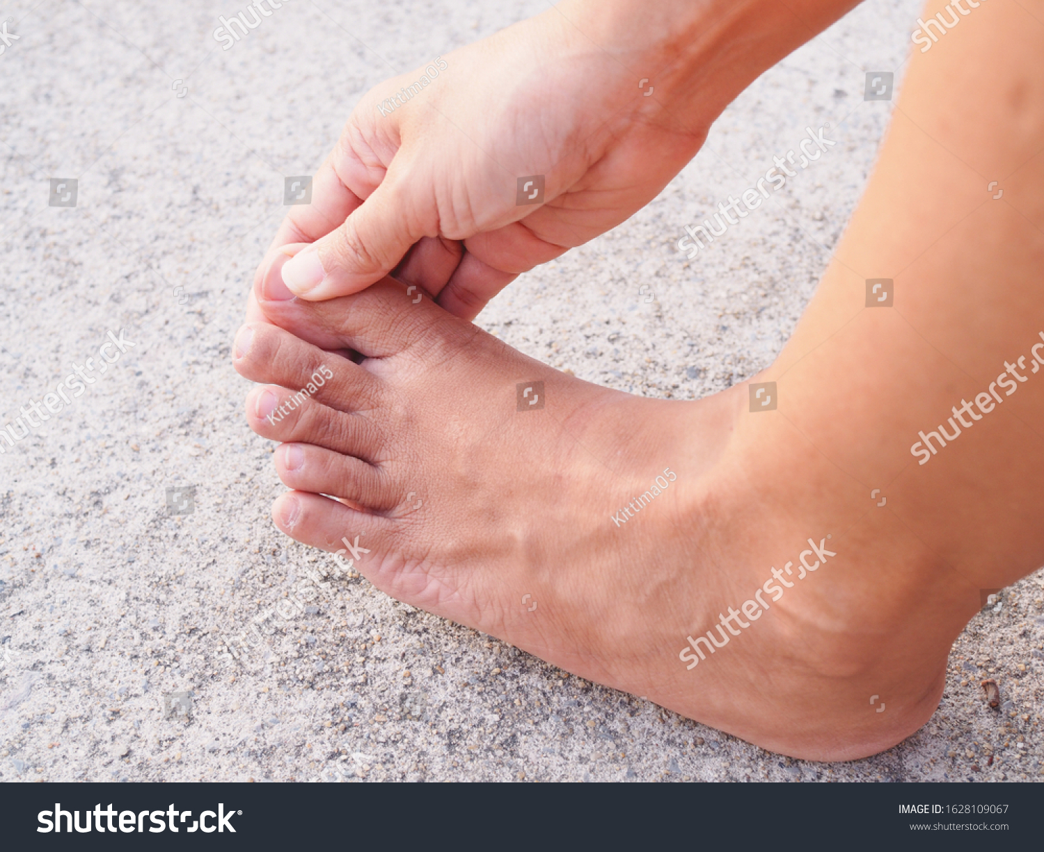 Sore Feet Symptoms Inflammation Foot Nerve Stock Photo 1628109067 ...