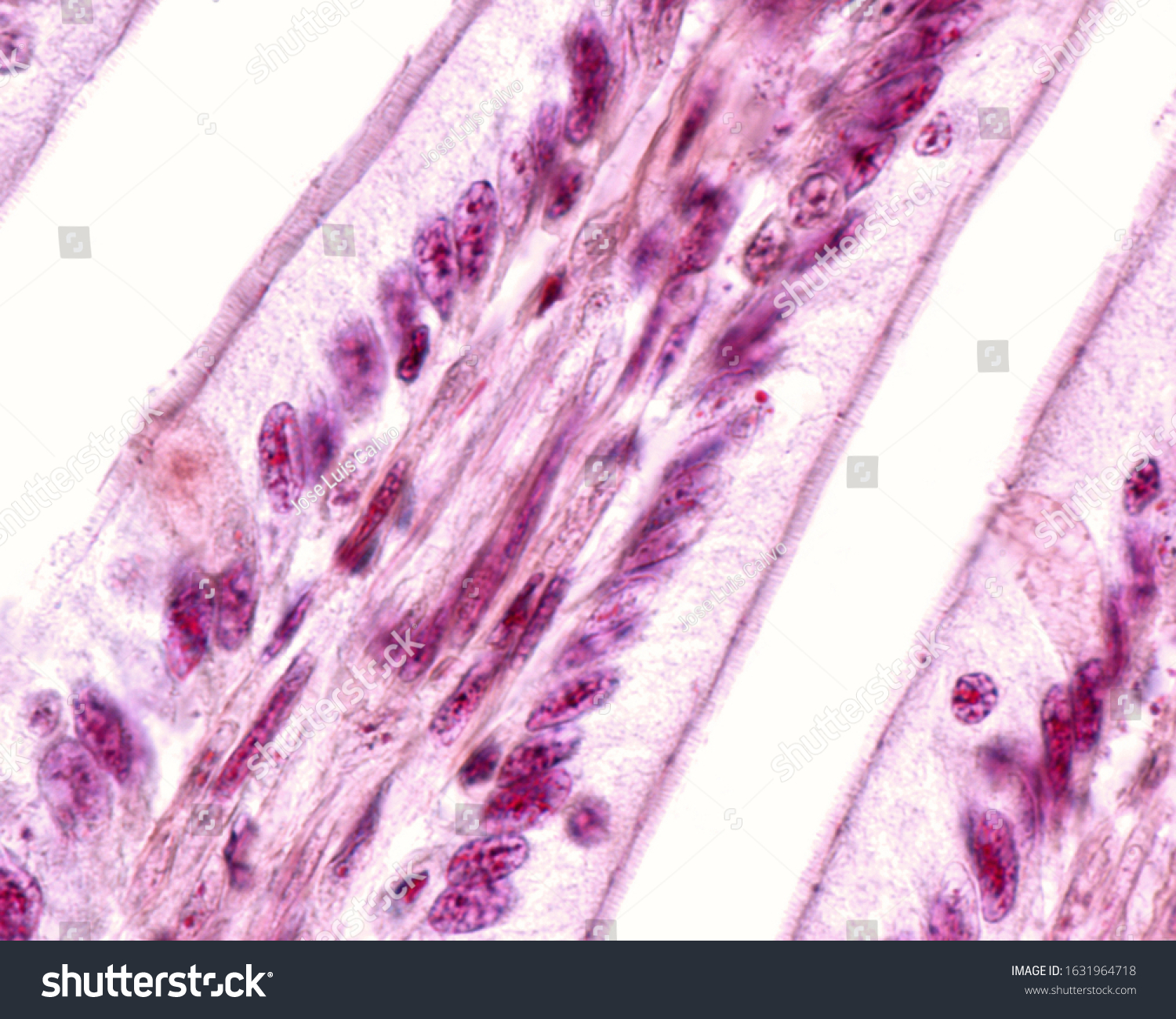 Simple Columnar Epithelium Small Intestine Showing Stock Photo ...