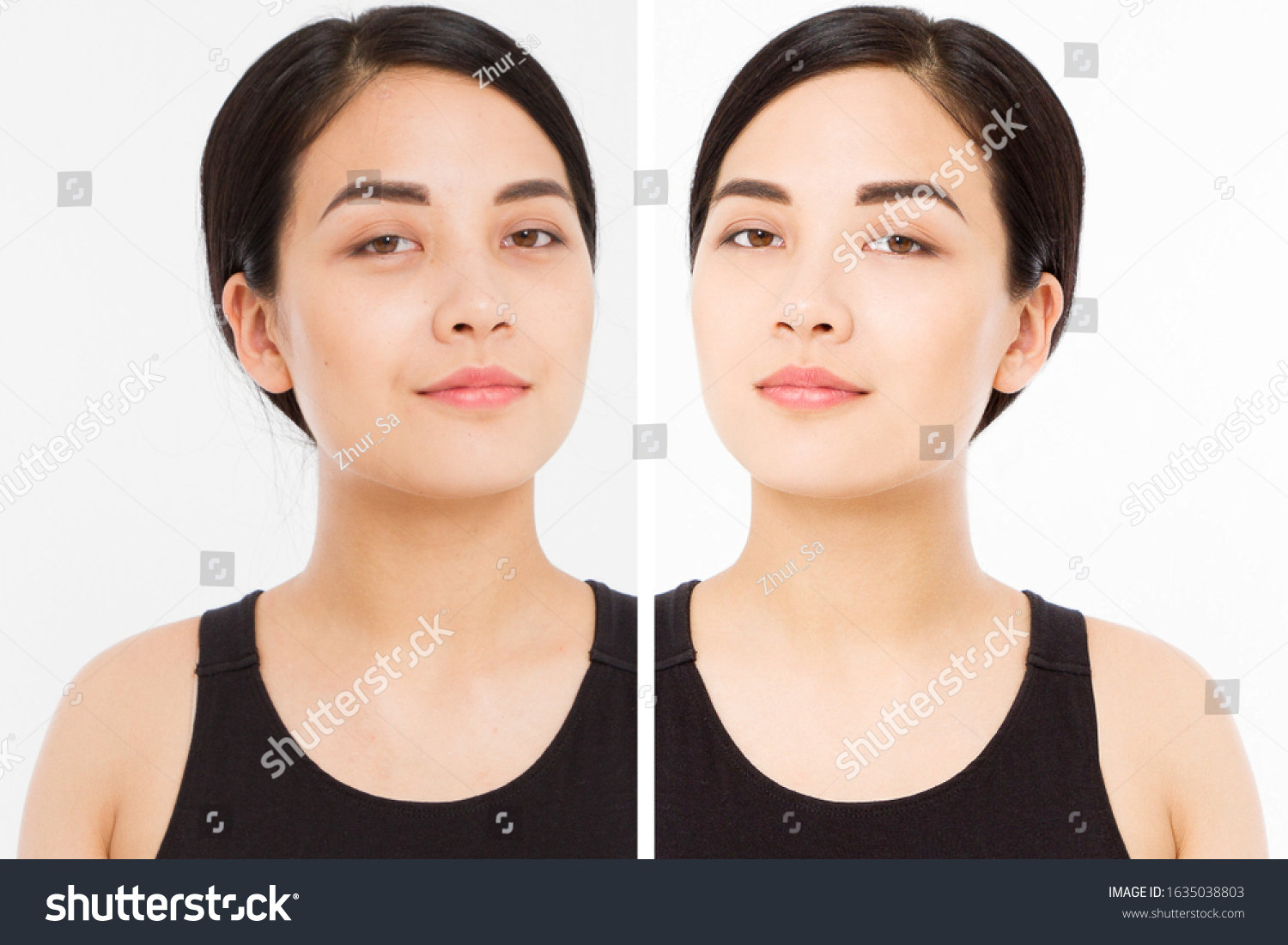 Closeup Before After Asian Woman Face Stock Photo 1635038803 | Shutterstock