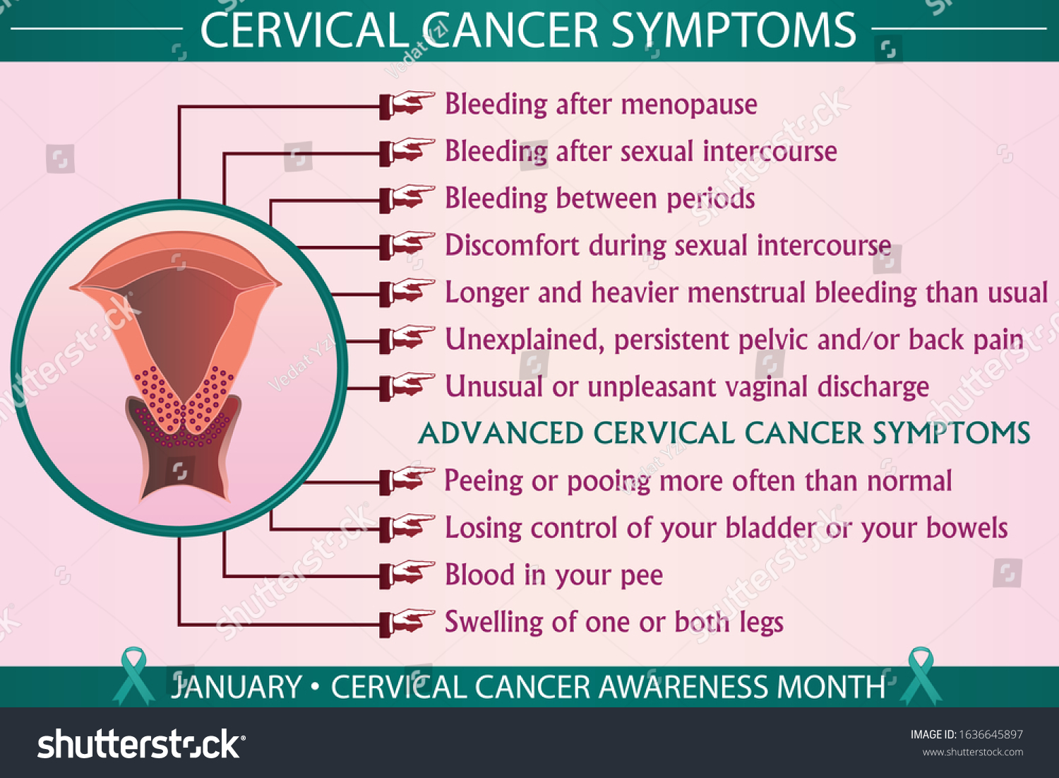 Cervical Cancer Disease Symptoms Infographic Vector Stock Vector ...