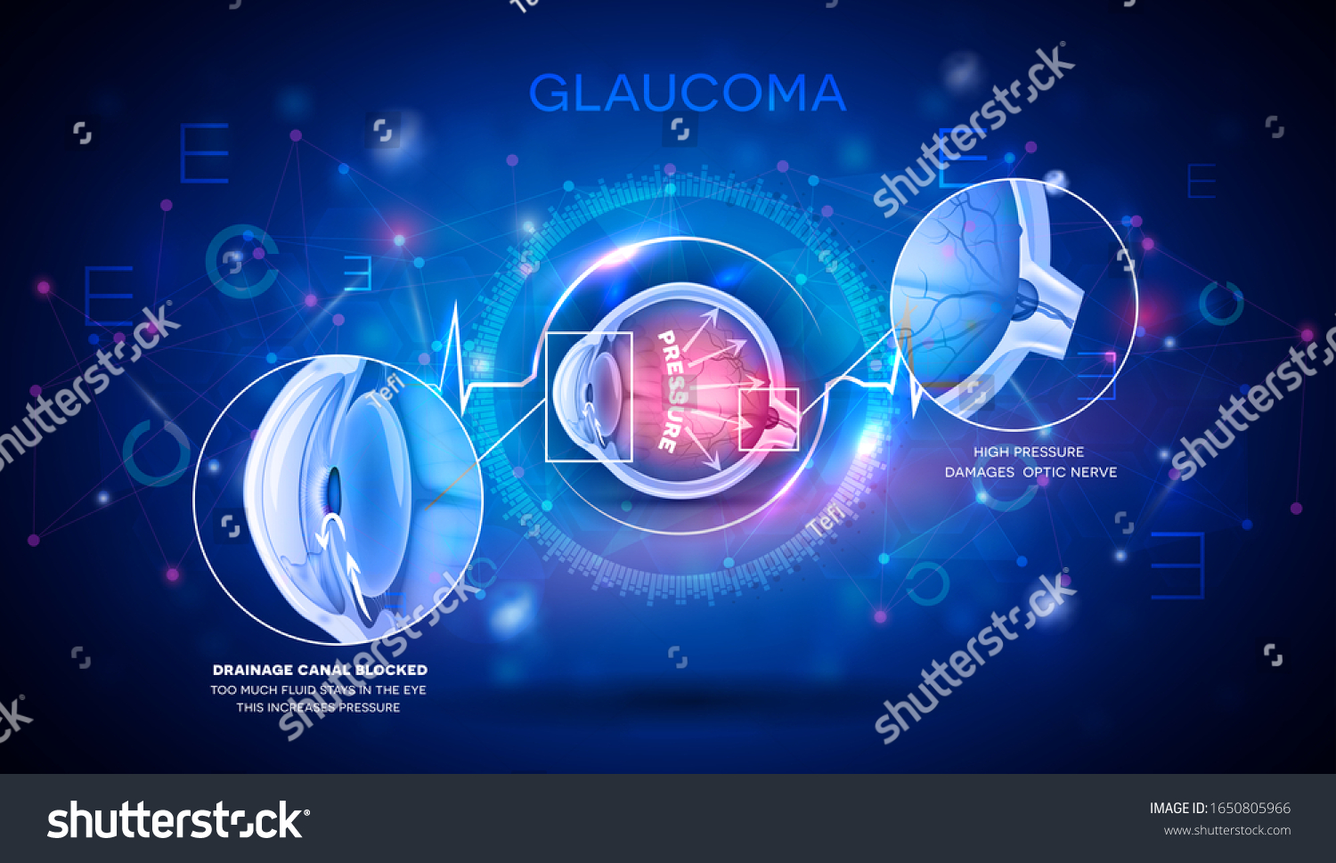 Glaucoma Vision Disorder Abstract Blue Scientific Stock Vector (Royalty ...