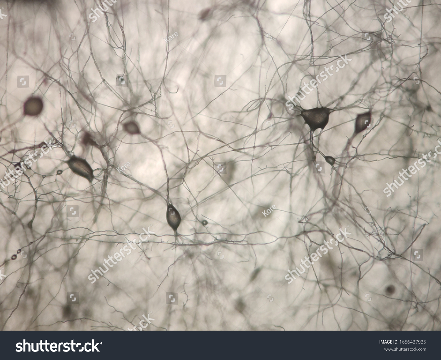 Mycelium Dermatophyte Fungus Microscope View Stock Photo 1656437935 ...