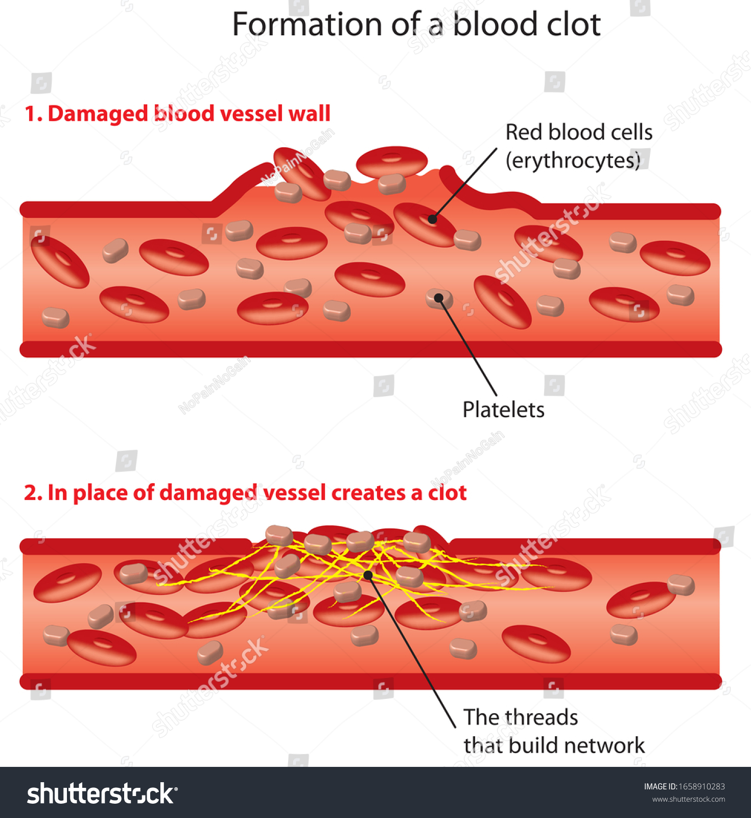 Illustration Formation Blood Clot Stock Illustration 1658910283 ...