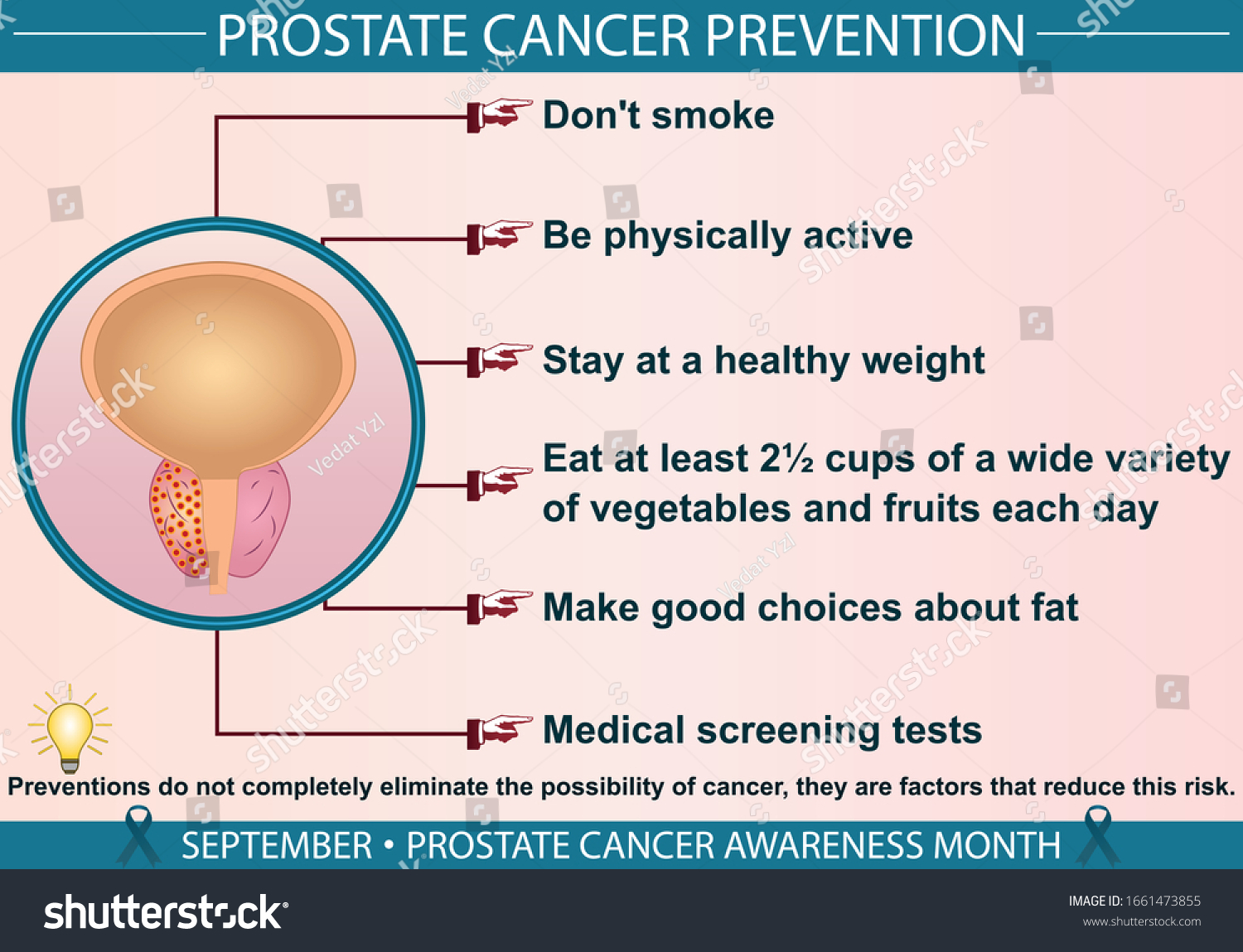 Prostate Cancer Disease Prevention Infographic Vector Stock Vector ...