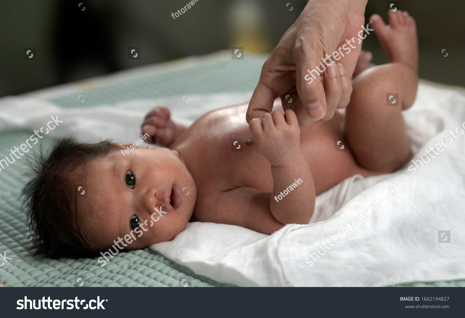 newborn-baby-has-rash-red-spots-stock-photo-1662194827-shutterstock