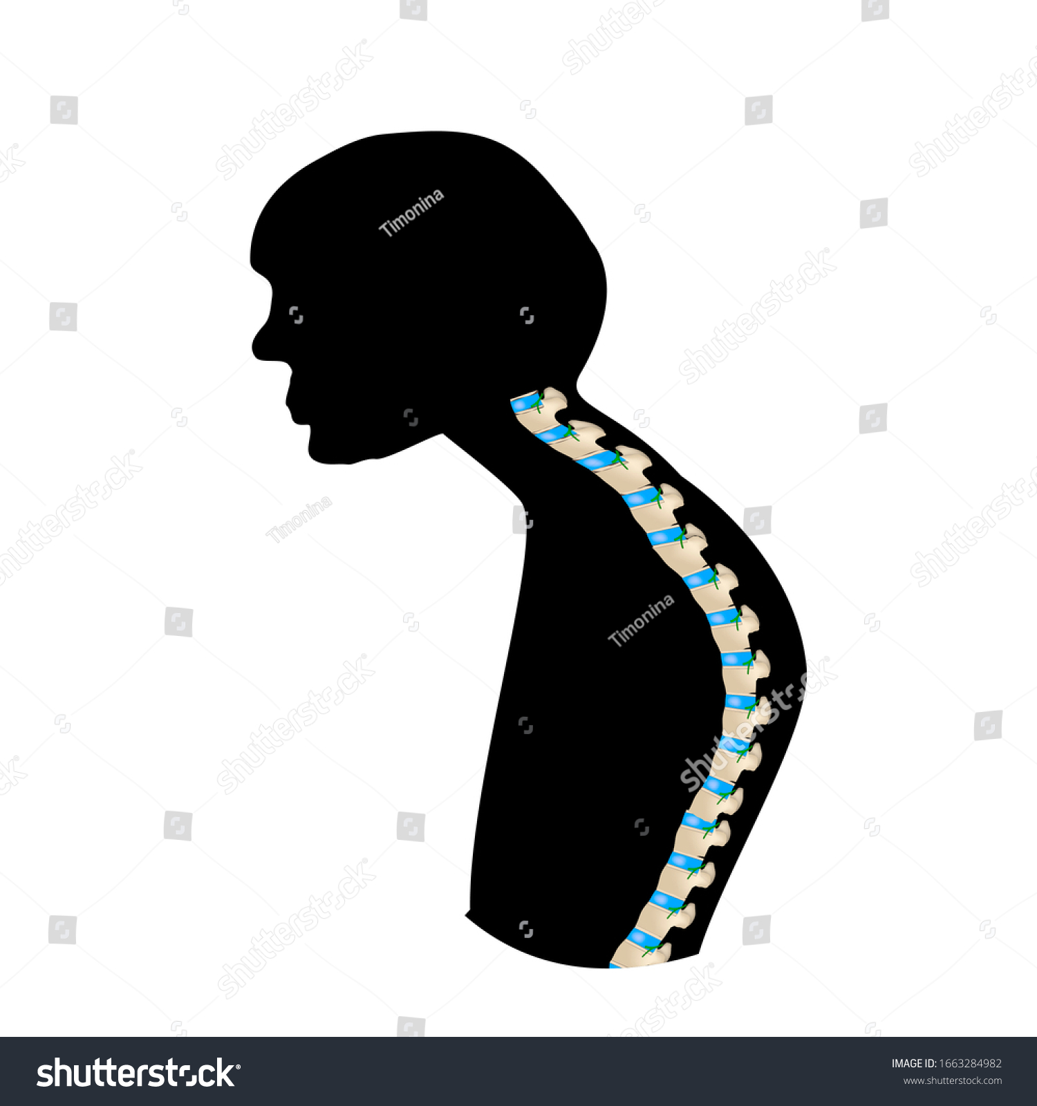 Position Spine Kyphosis Black White Silhouette Stock Illustration ...