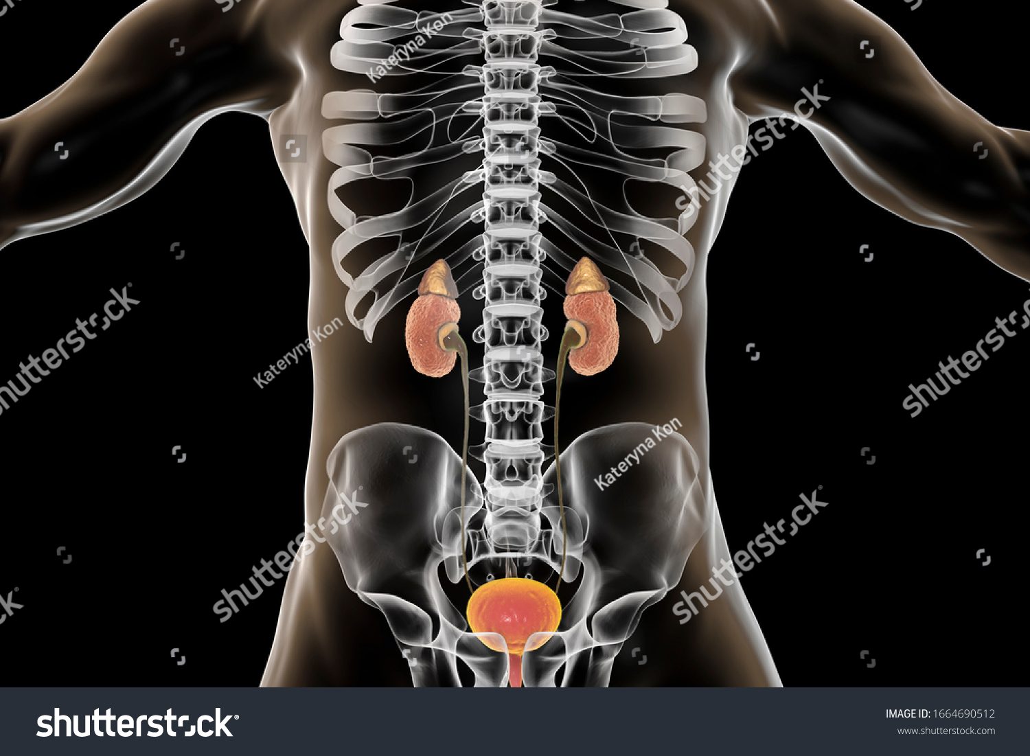 Chronic Glomerulonephritis Gross Pathology Scientifically Accurate ...