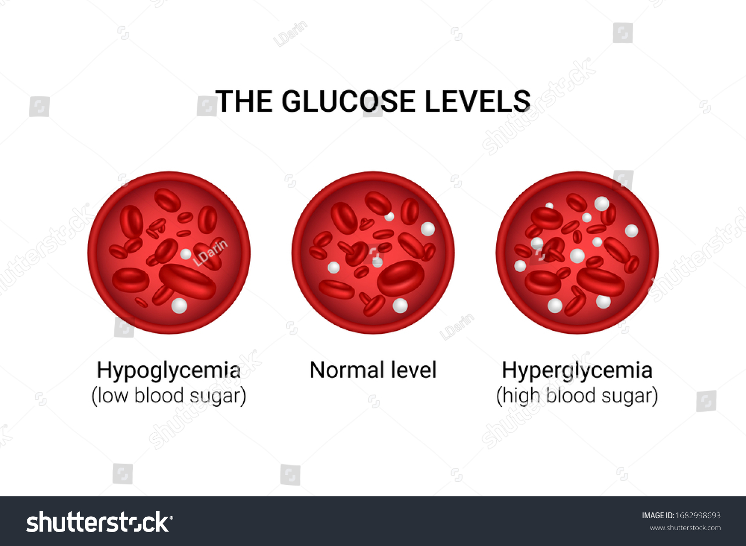 Vector Illustration Glucose Levels Blood Hypoglycemia Stock Vector ...