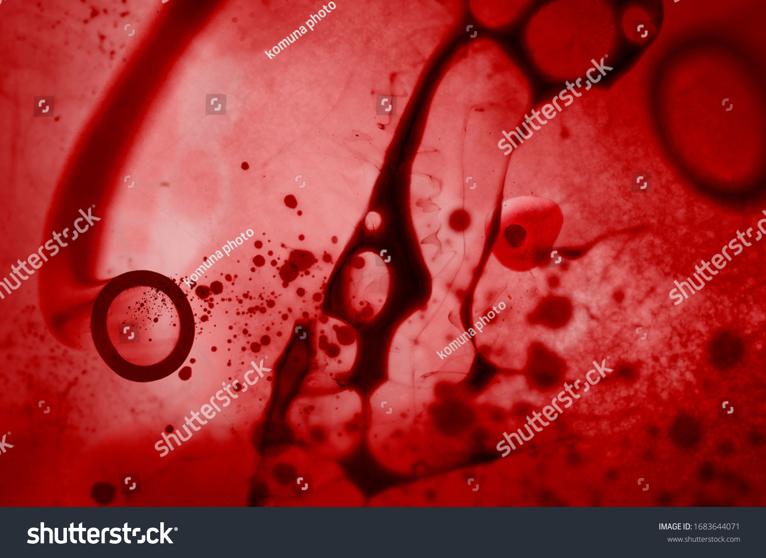 Aortic Aneurysm Rupture 3d Rendering Stock Illustration 1683644071 ...