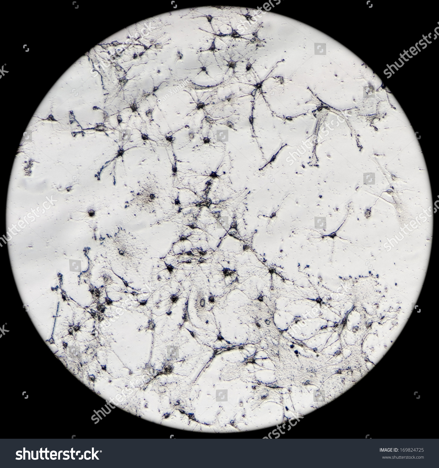 Micrograph Nerve Cell Nervous Physiology Science Stock Photo 169824725 ...