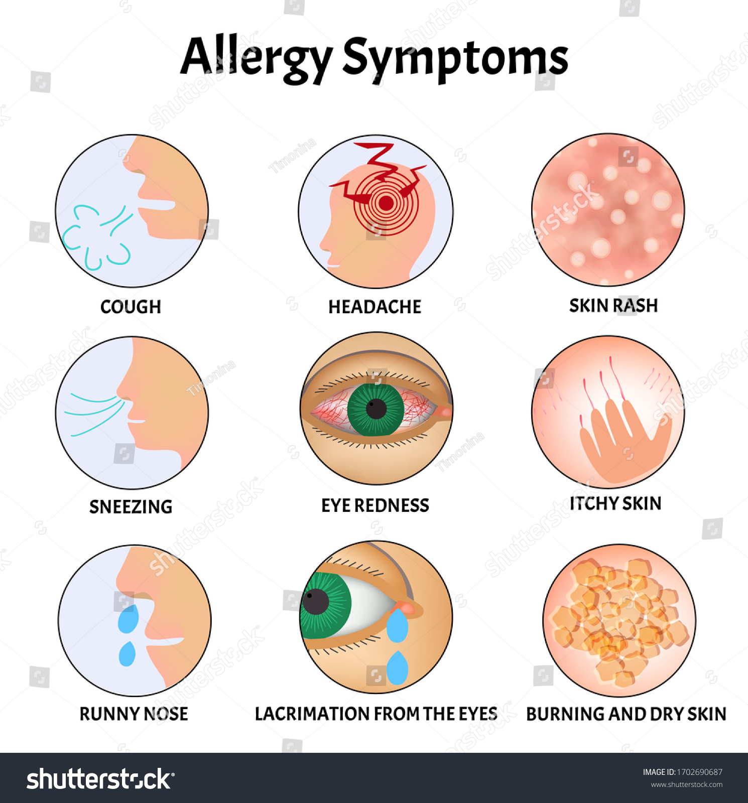 Gin Allergy Symptoms