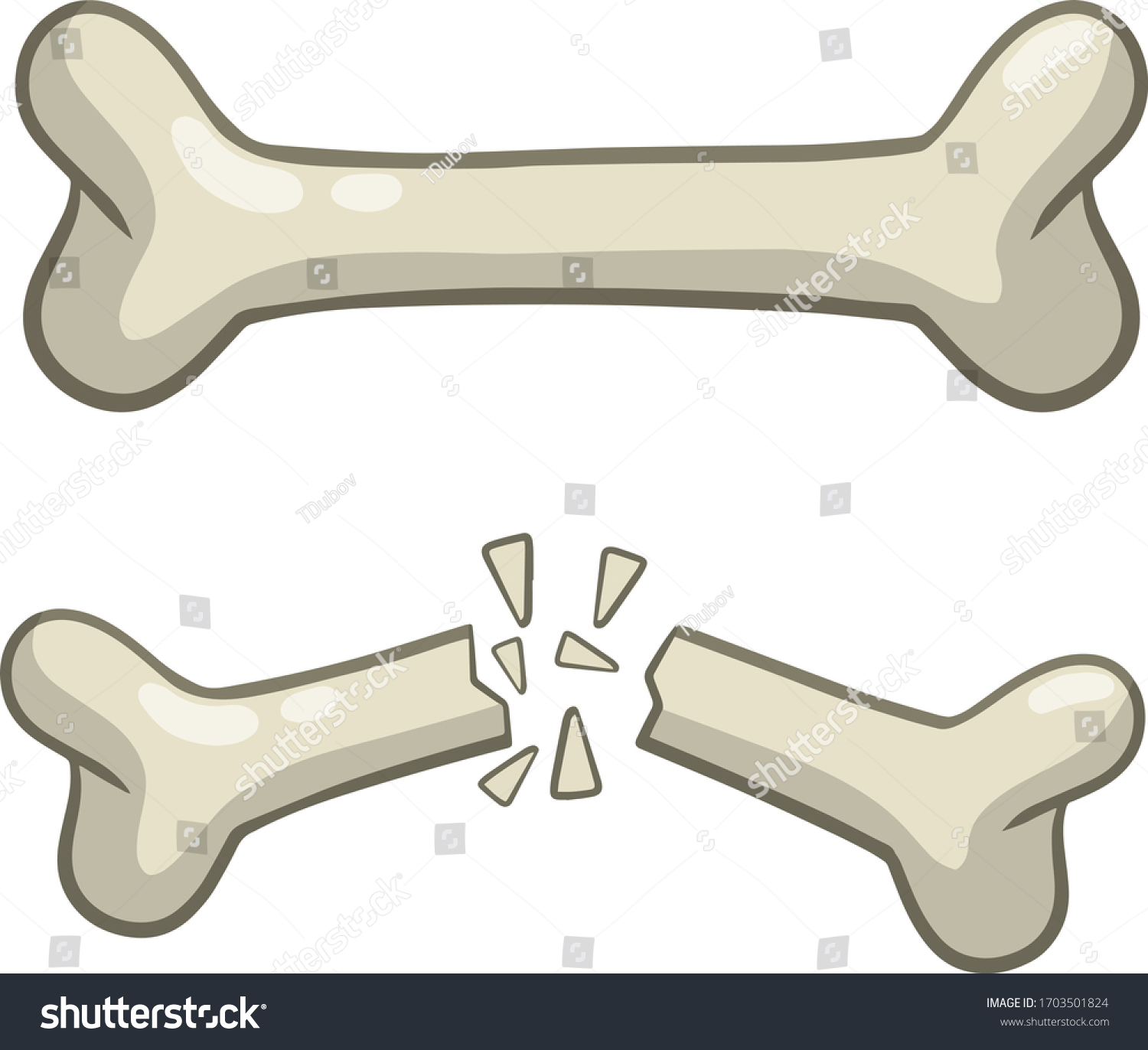 231 Splinter Bone Images, Stock Photos & Vectors | Shutterstock