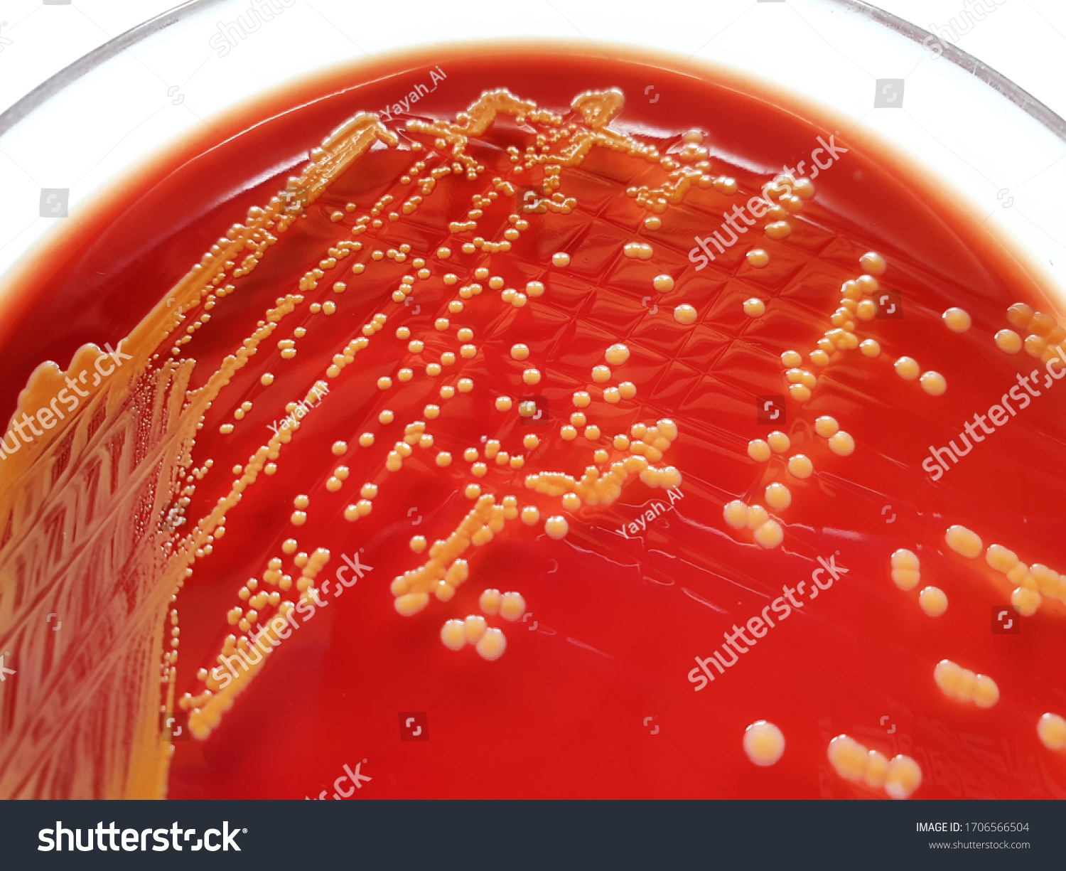 Closeup Yellow Colonies Staphylococcus Aureus Bacteria Stock Photo ...