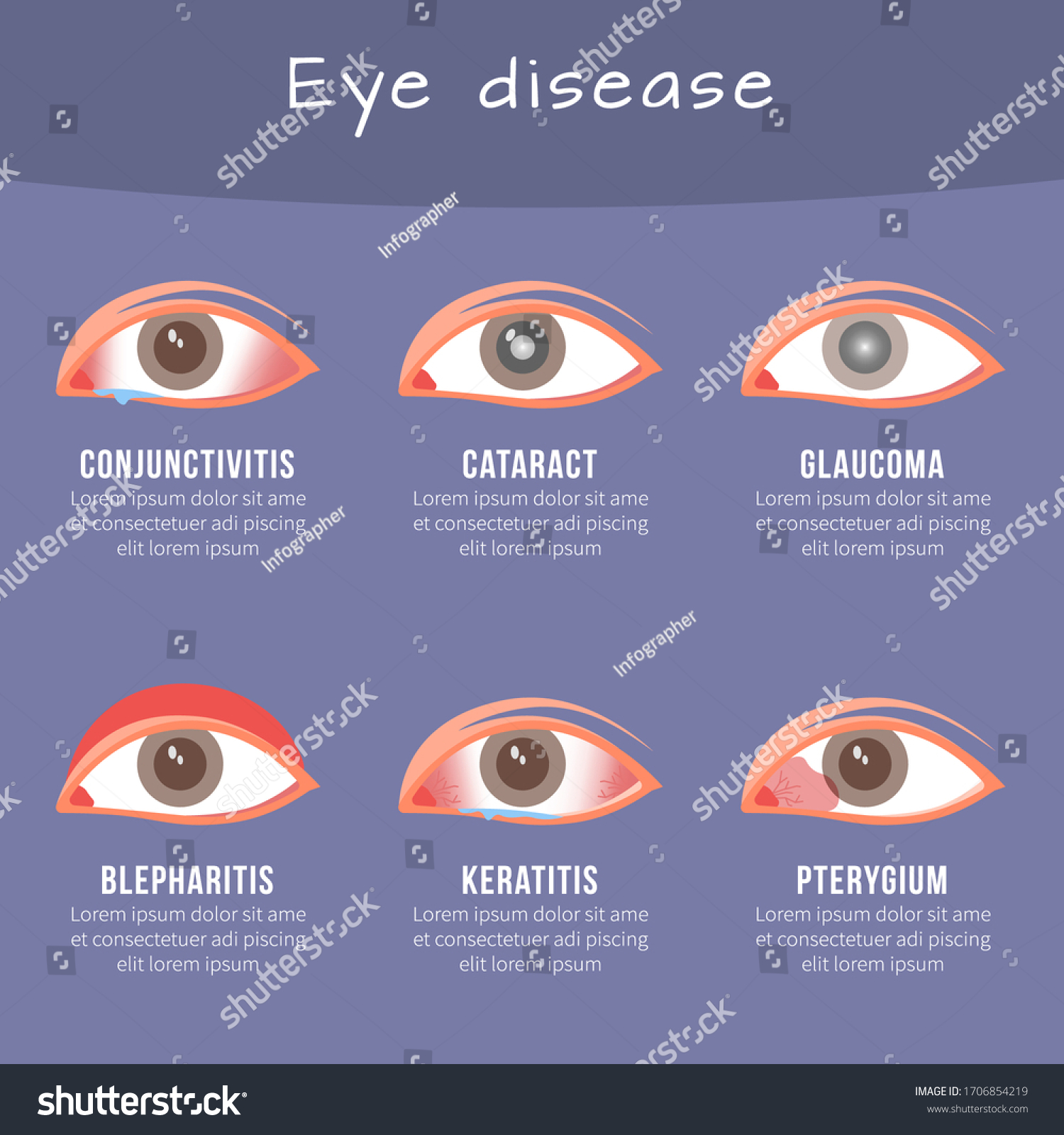 Eye Disease Infographic Template Healthcare Medical Stock Vector ...