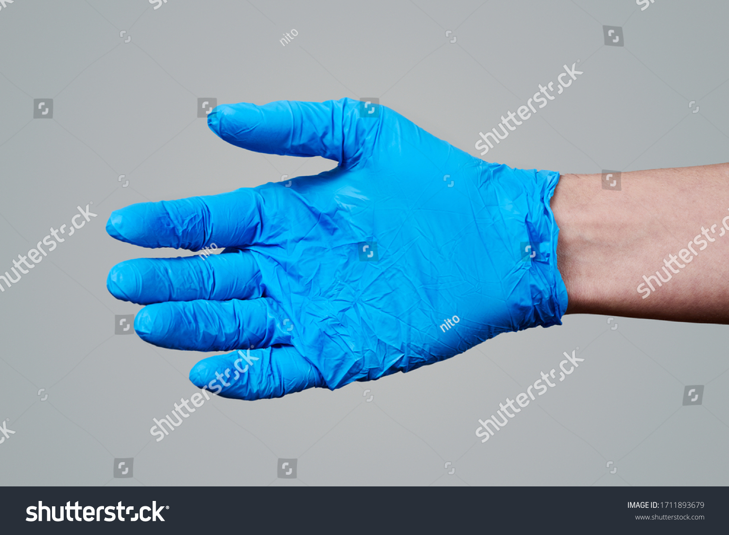 polydactyly gloves