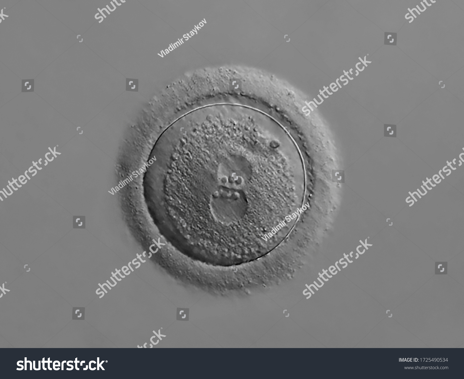 Photomicrograph Isolated Human Zygote Two Pronuclei Stock Photo ...