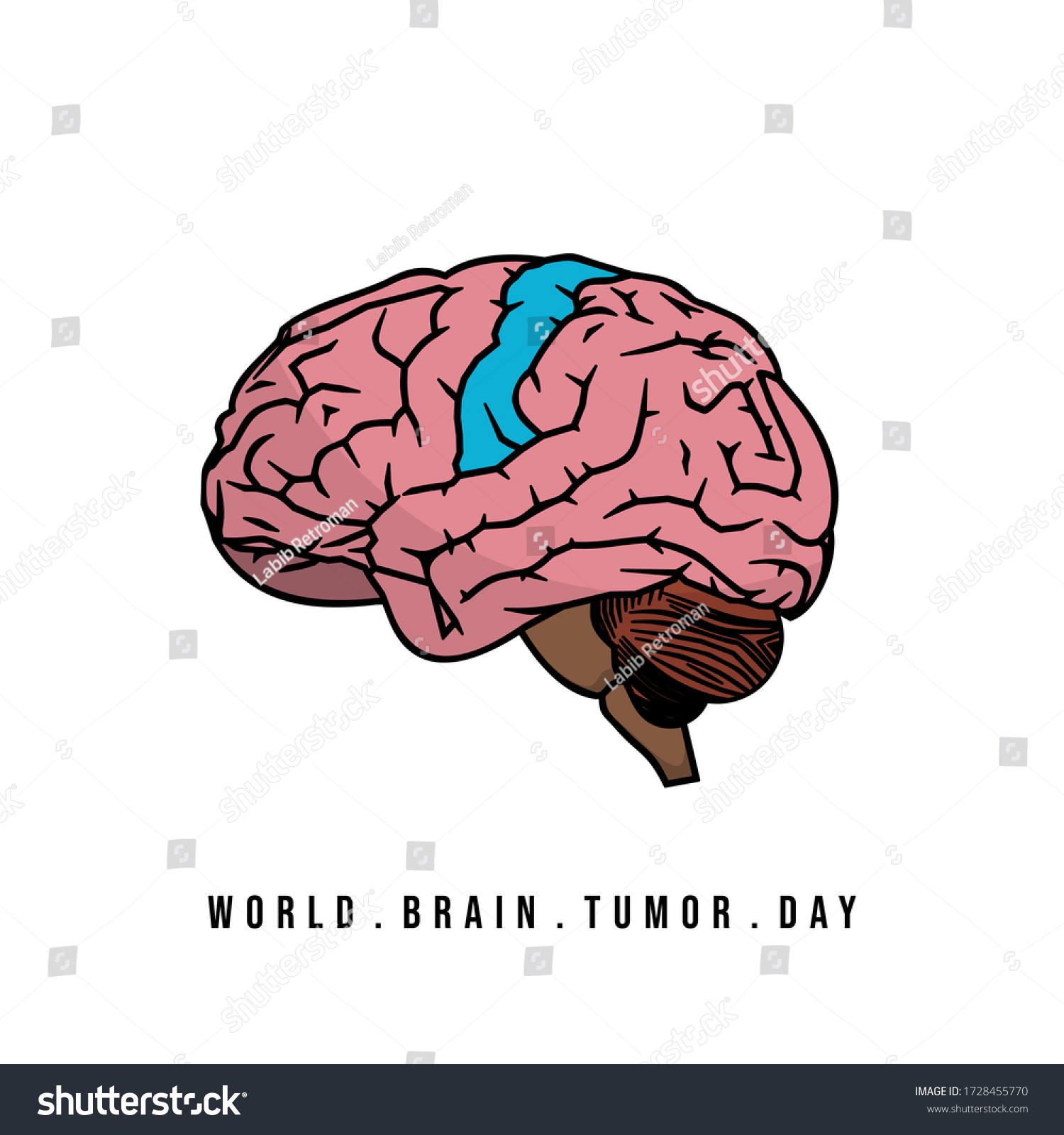 Vector Illustration Brain Brain Tumor Concept Stock Vector Royalty Free 1728455770 Shutterstock 1498