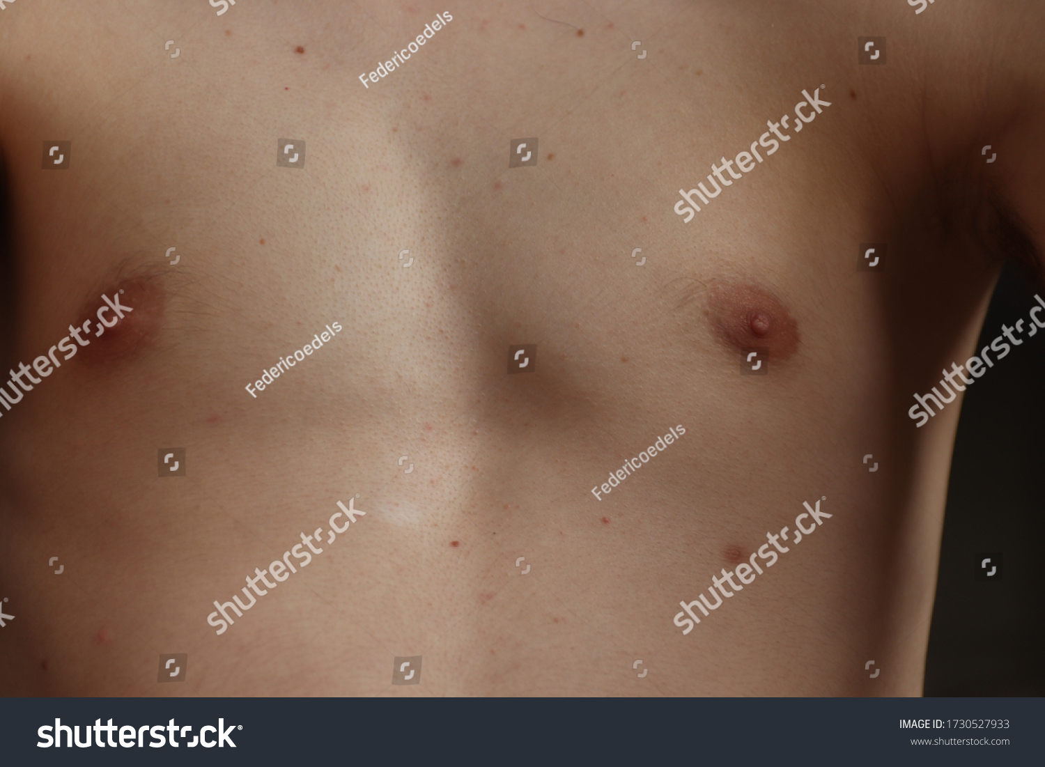 Close Up Of Nipples