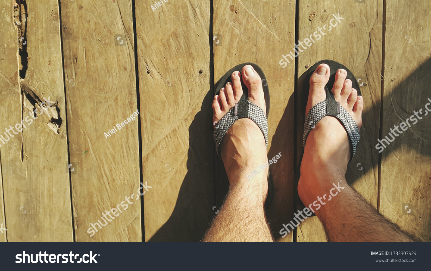 hairy feet in flip flops