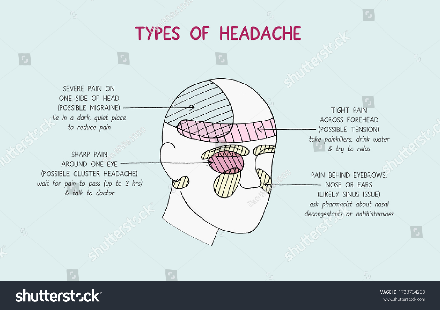 different types of headache essay