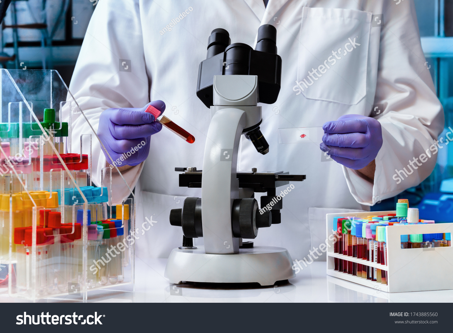 Doctor Examining Blood Sample Slide Microscope Stock Photo 1743885560 ...