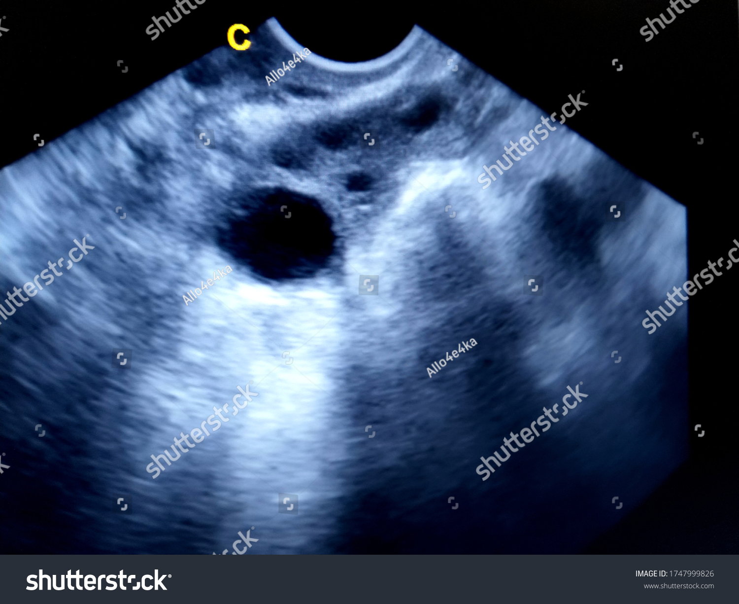 1747999826-dominant-follicle-ovary-by-ultrasound