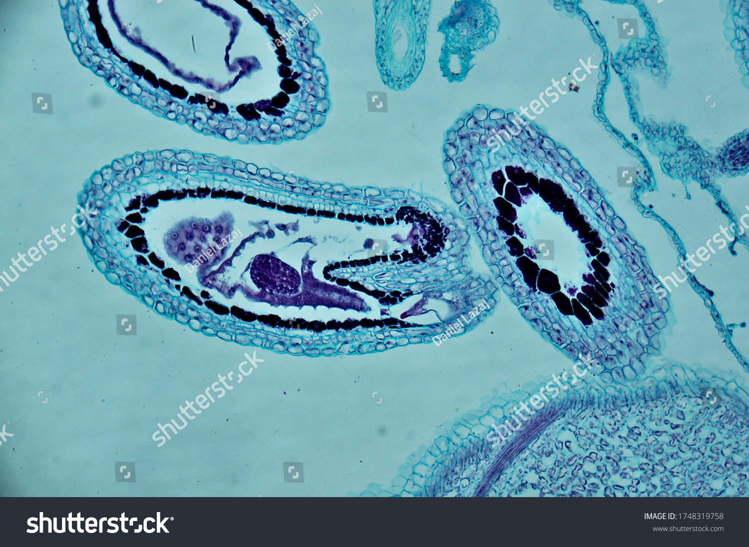 Capsella Young Embryo Sec Under Microscope Stock Photo 1748319758 ...