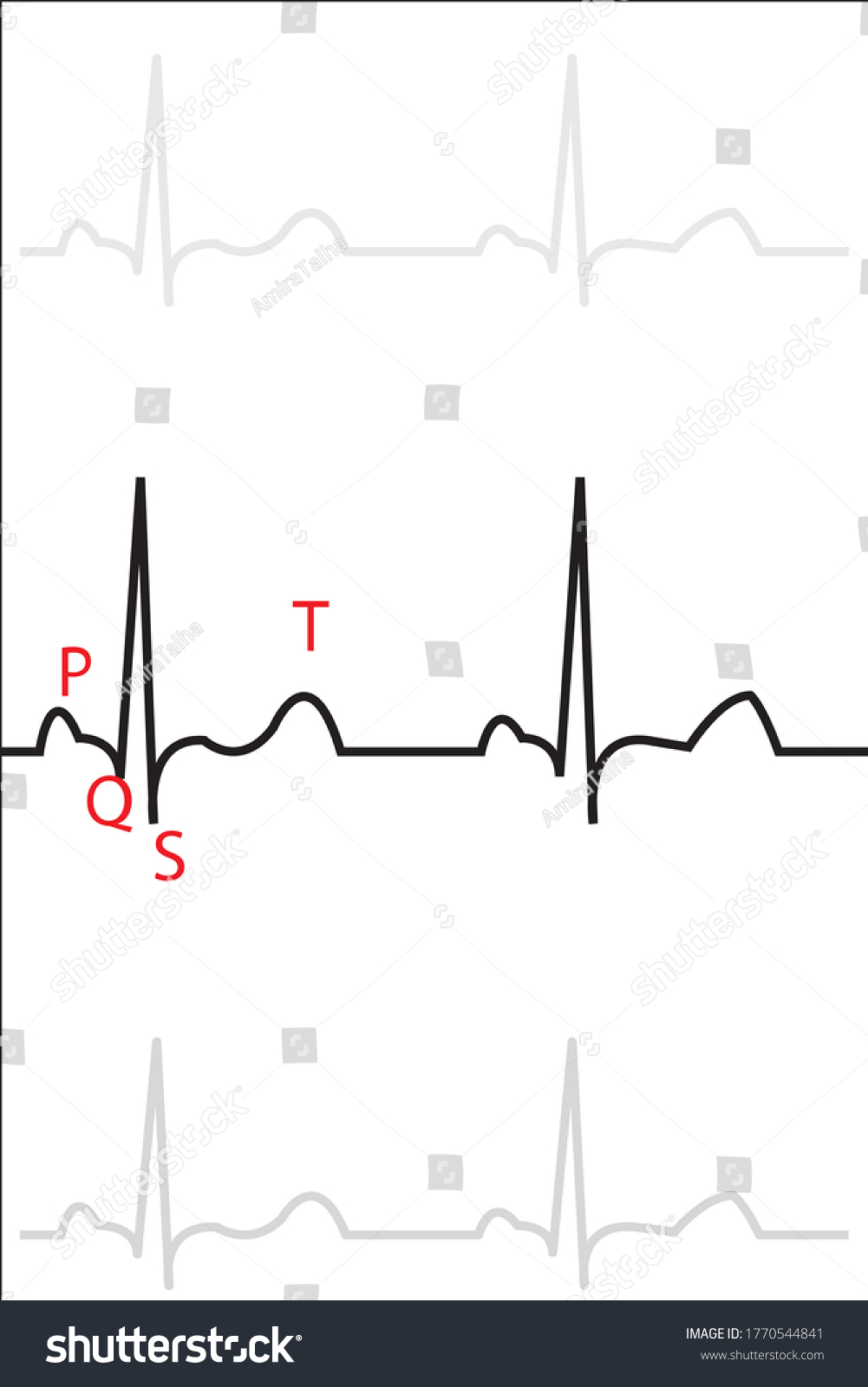 Ecg Wave Illustration Normal Heart Stock Illustration 1770544841 ...