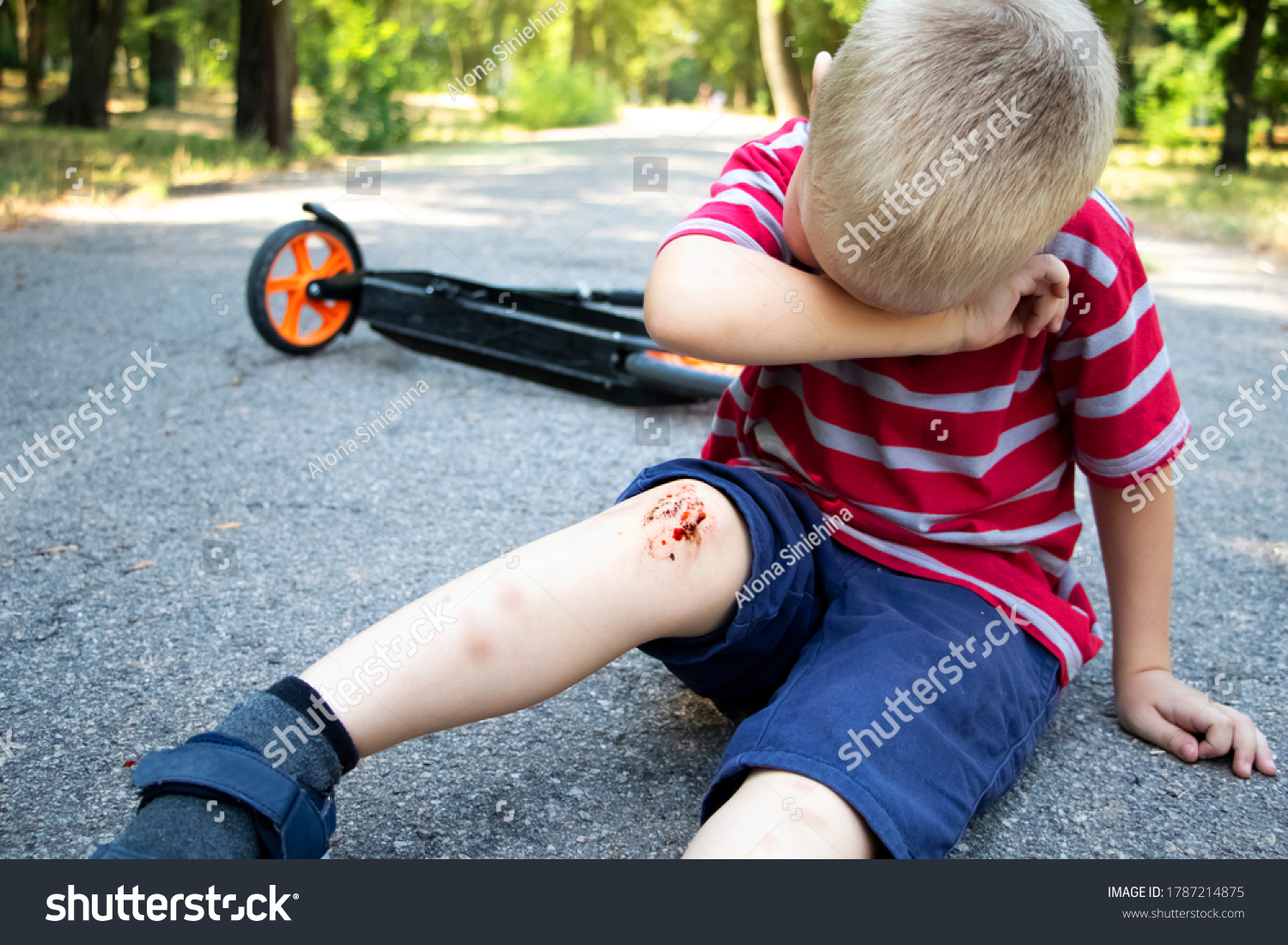 fouryearold-boy-fell-off-scooter-broke-foto-stok-1787214875-shutterstock