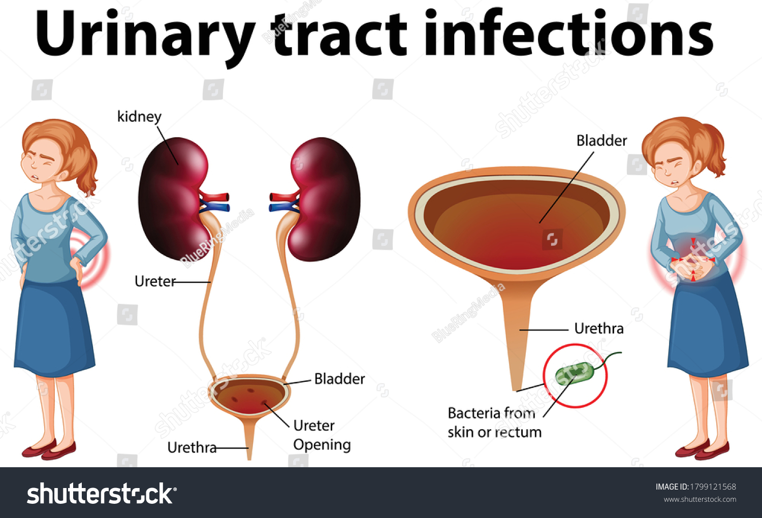 Male Urinary tract infection
