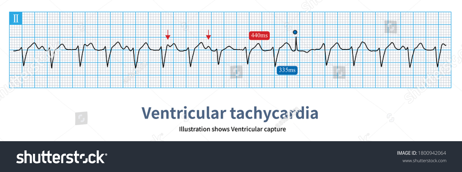 11 Sinus capture Images, Stock Photos & Vectors | Shutterstock