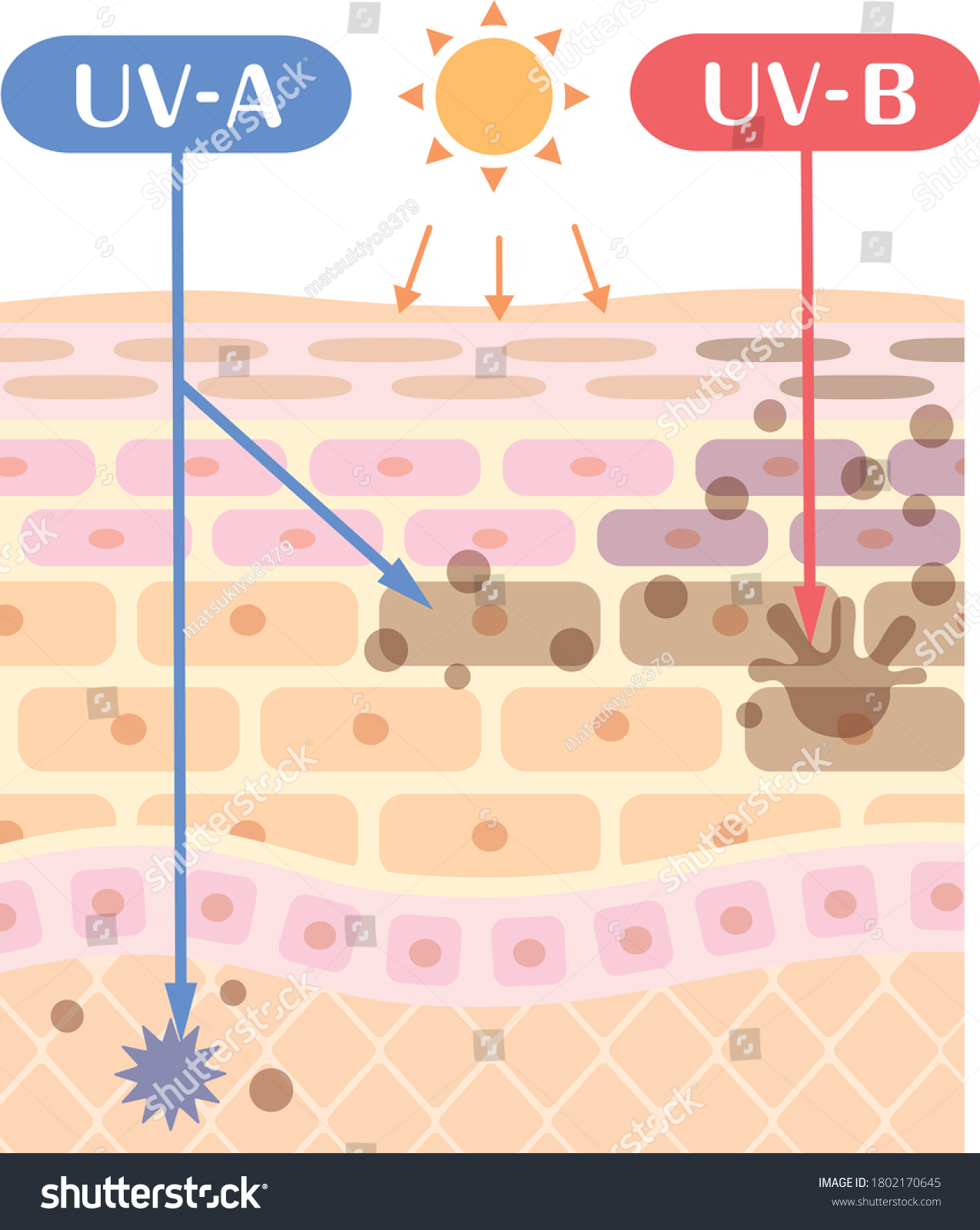 Mechanism Explanation Illustration Sunburn Stock Vector (Royalty Free ...