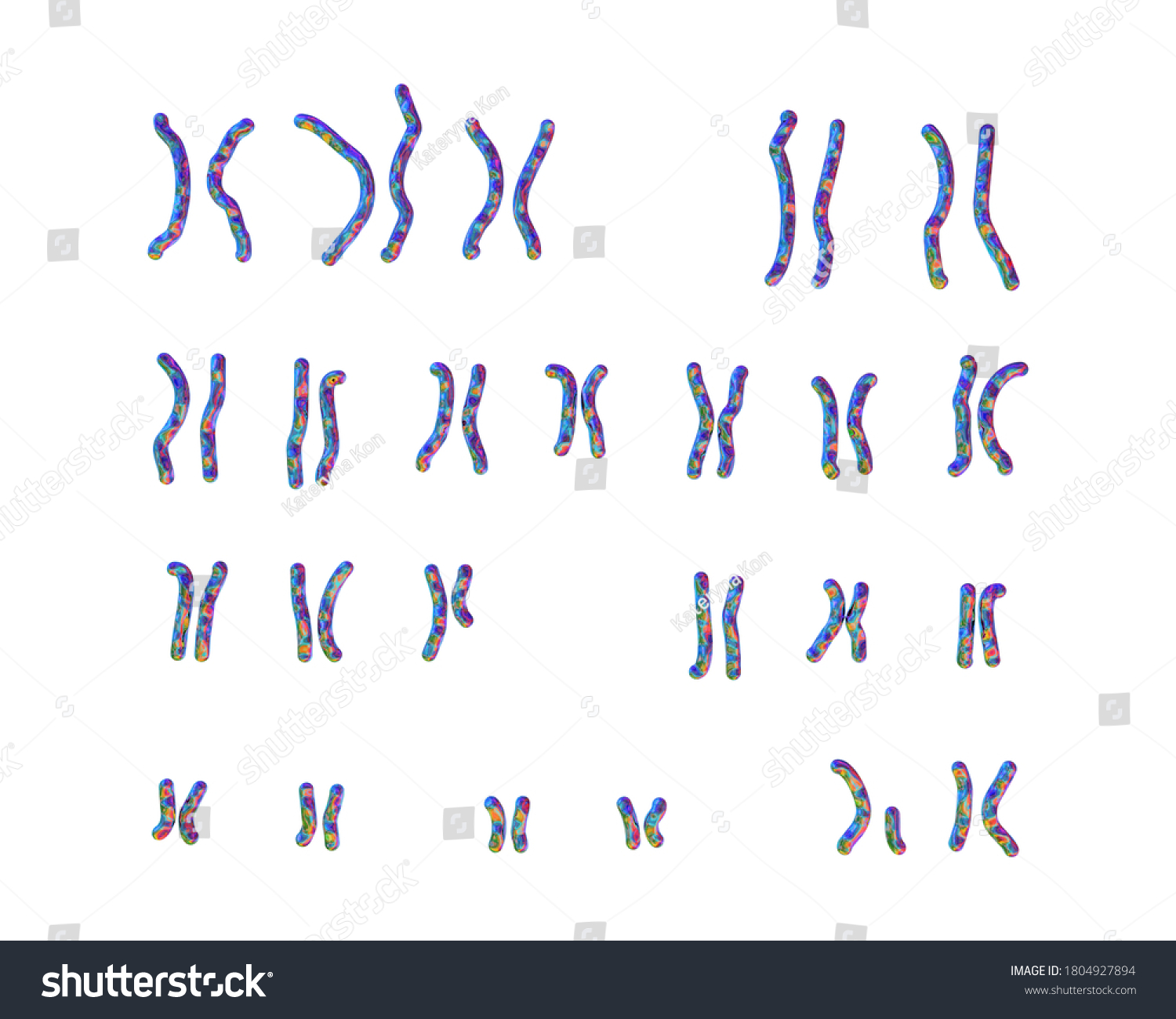 Karyotype Praderwilli Syndrome 3d Illustration Genetic Stock ...