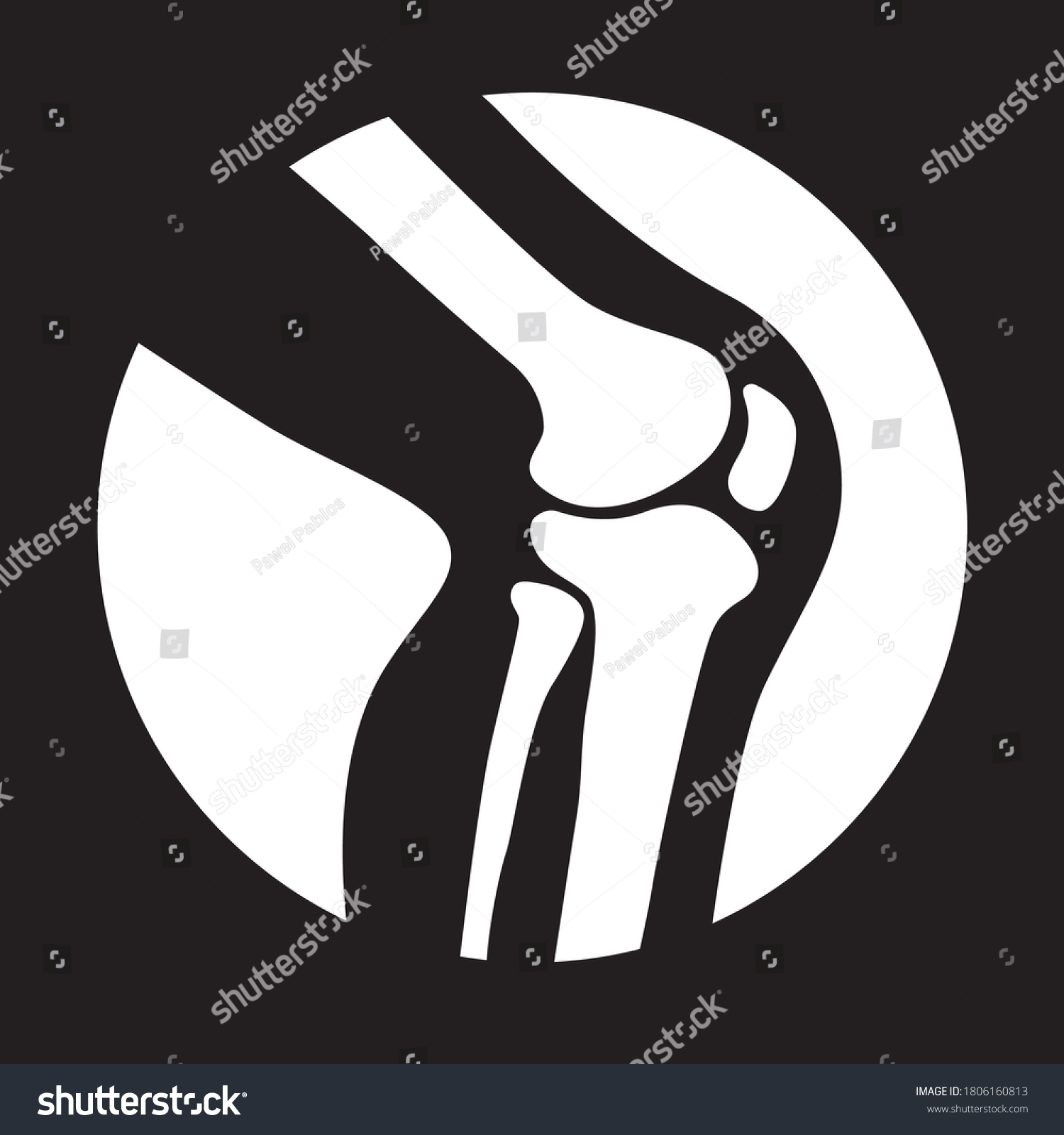 Human Knee Joint Side View Isolated Stock Vector (Royalty Free ...